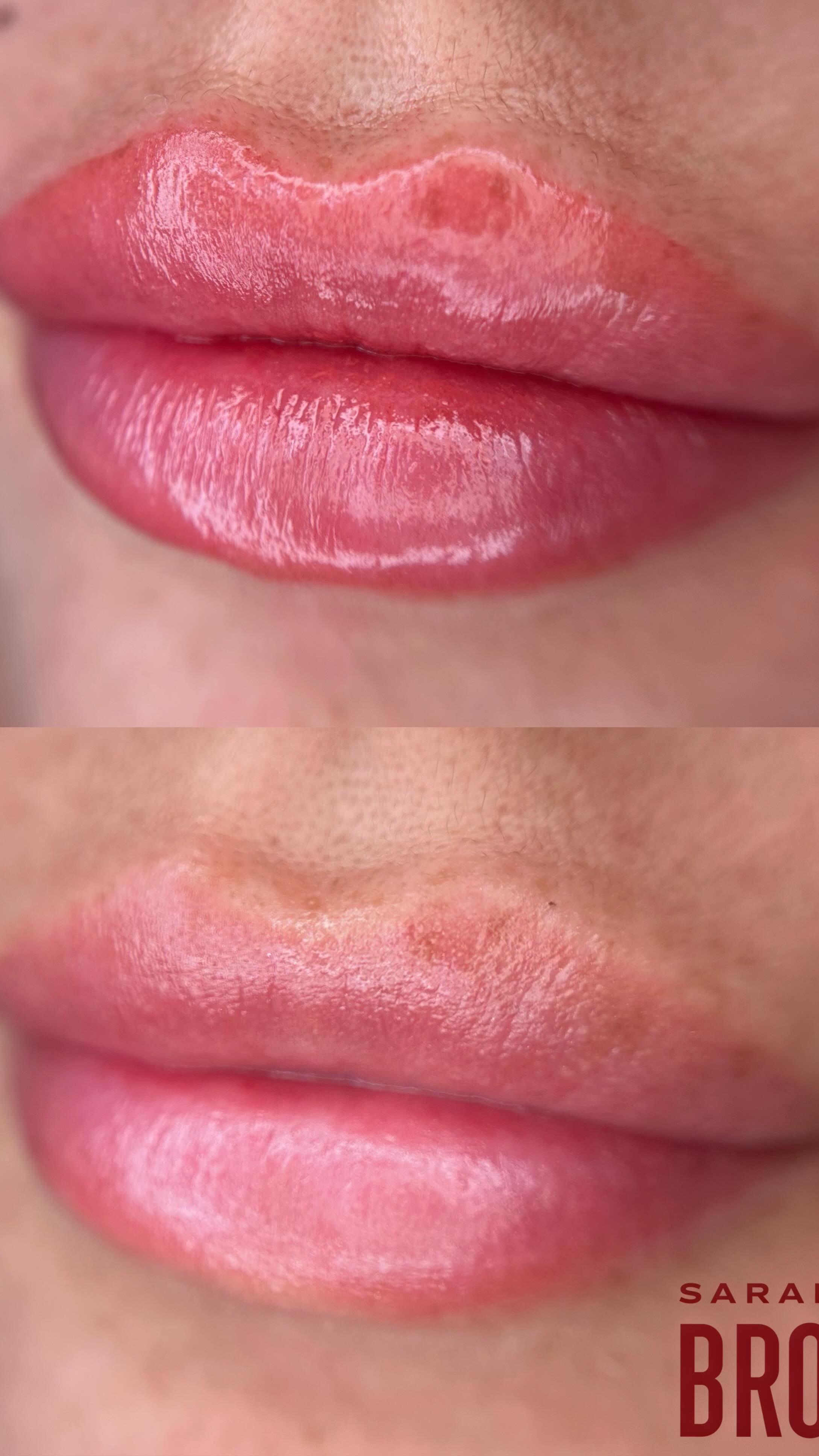 Coming to the feed soon đ¤¤
~ Lip Tint Tattoo
~ Completely customised colour and shape to suit each individuals wants/needs.
~ Artist: Sarah Lea
~ Lasts 2+ years
~ Anaesthetic used throughout
~ Southport, Gold Coast đ
~ Bookings & Info:
www.sarahleabrows.com