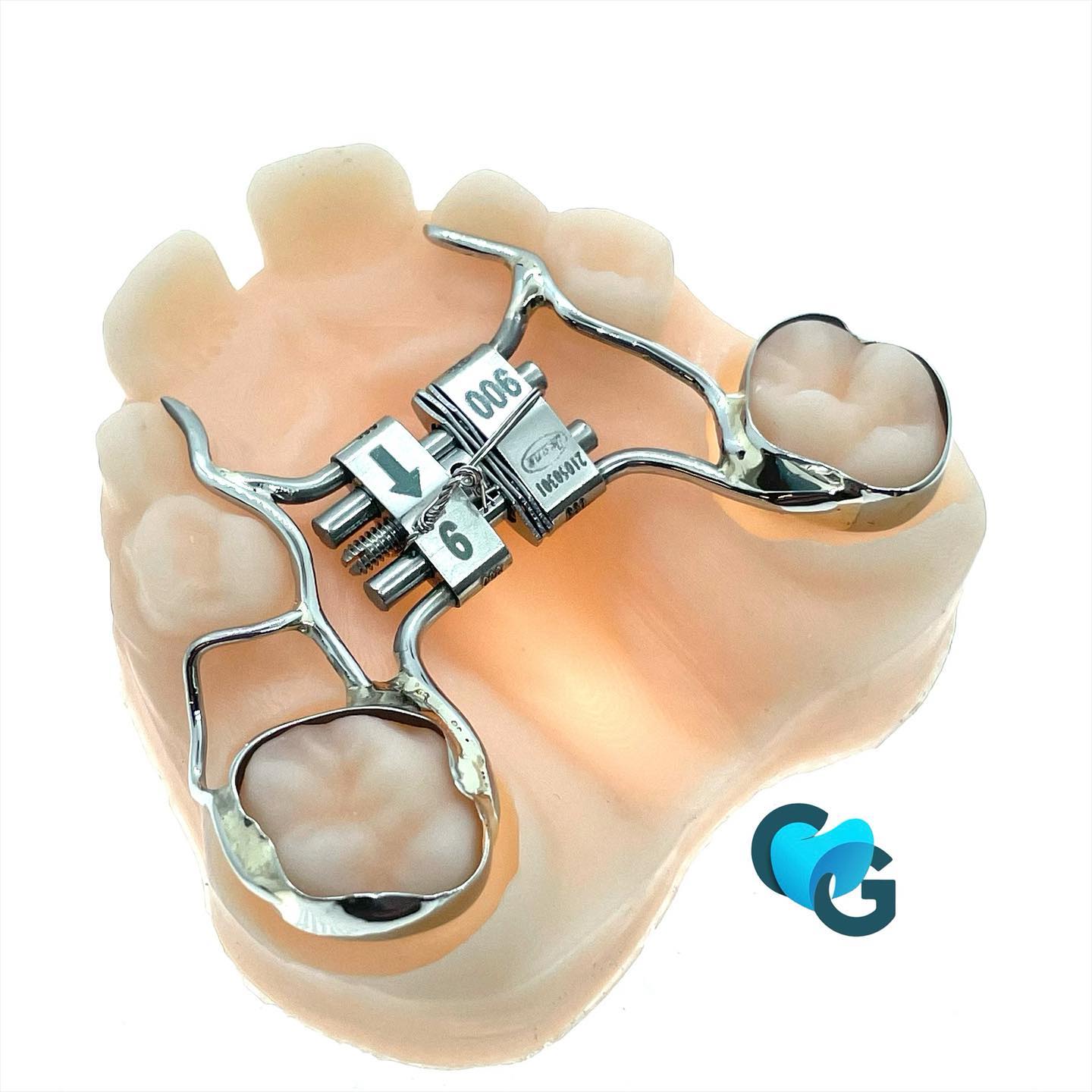 Leafexpander et garde place 15 #leafexpander #leafex #leafdental #leone #expensionforce #ortho #orthodontie #expension #pexpensionfix#orthosuisse #orthopassion #orthotechnicianart #labodentaire#