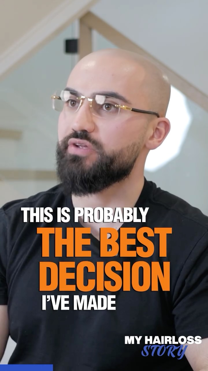 For Behzad, this wasn’t just a procedure - it was the best decision he’s made as an adult.
There is nothing we love more than hearing that our clients are inspiring their own family members to regain their confidence. Behzad’s favorite part? Convincing people he actually has SMP done! When it looks this natural, even those closest to you can’t tell where the real hair ends and the scalp micropigmentation begins.
We’re so proud to have been part of this journey with you, Behzad! ❤️