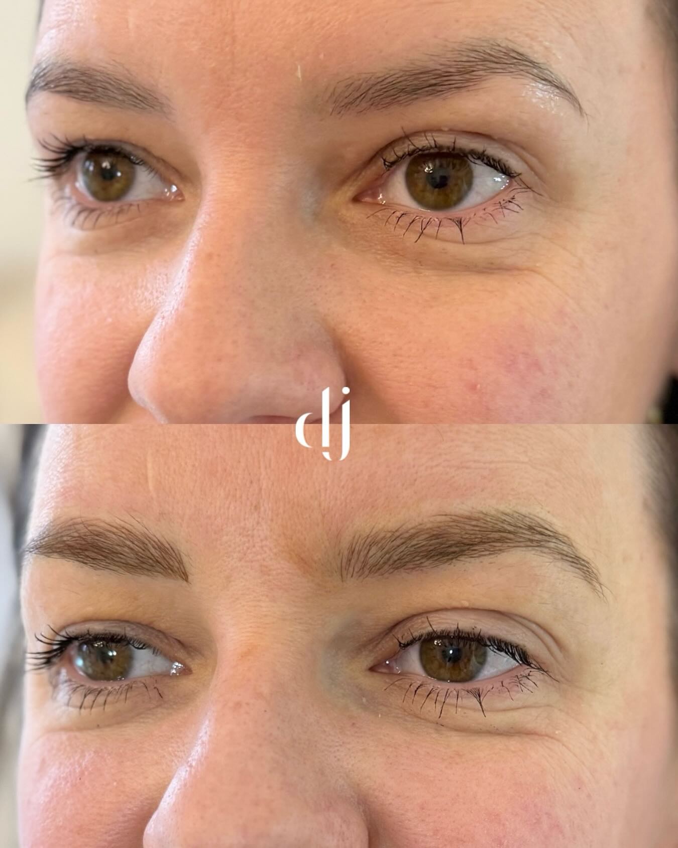 Brows hyper real, hair strokes throughout brow. A enhancement of permanent makeup without a tattoo brow look.
Treatment time - 1 hour
Price - £240
Top up price 6 weeks later £60
Consultation recommended
Book via the link 🔗
#permanentmakeup #pmubrows✍🏻️ #pmu #hairstrokeseyebrows #permanentmakeupartist