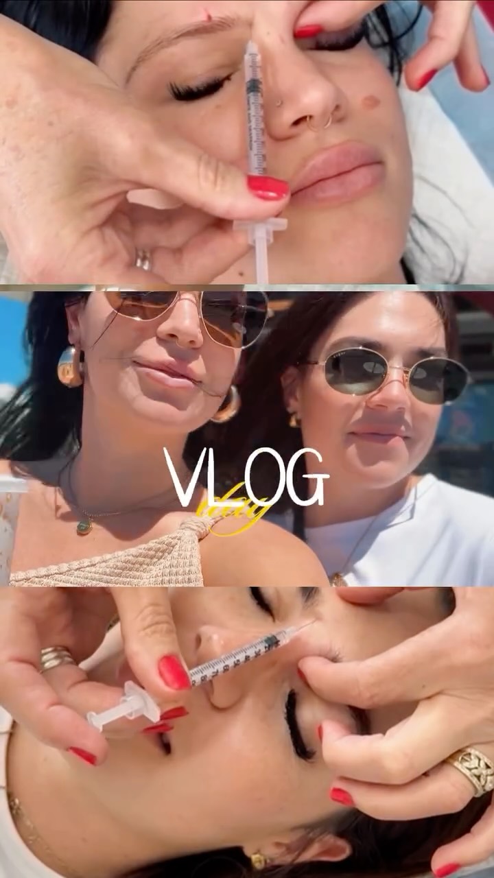 Self-care isn’t always bubble baths 🌸
Sometimes it’s smooth skin, relaxed frown lines, and choosing me.
Waxed ✔️
Refreshed ✔️
Feeling like that girl ✔️
Doing things that make me feel good — unapologetically 💅🏽
Soft skin. Soft energy. Strong boundaries.
✨ Confidence looks different on everyone ✨
⚠️ Disclaimer: This reel includes brief visuals of needless
#brazillianwax #botox #lifestyle #vlog #beauty