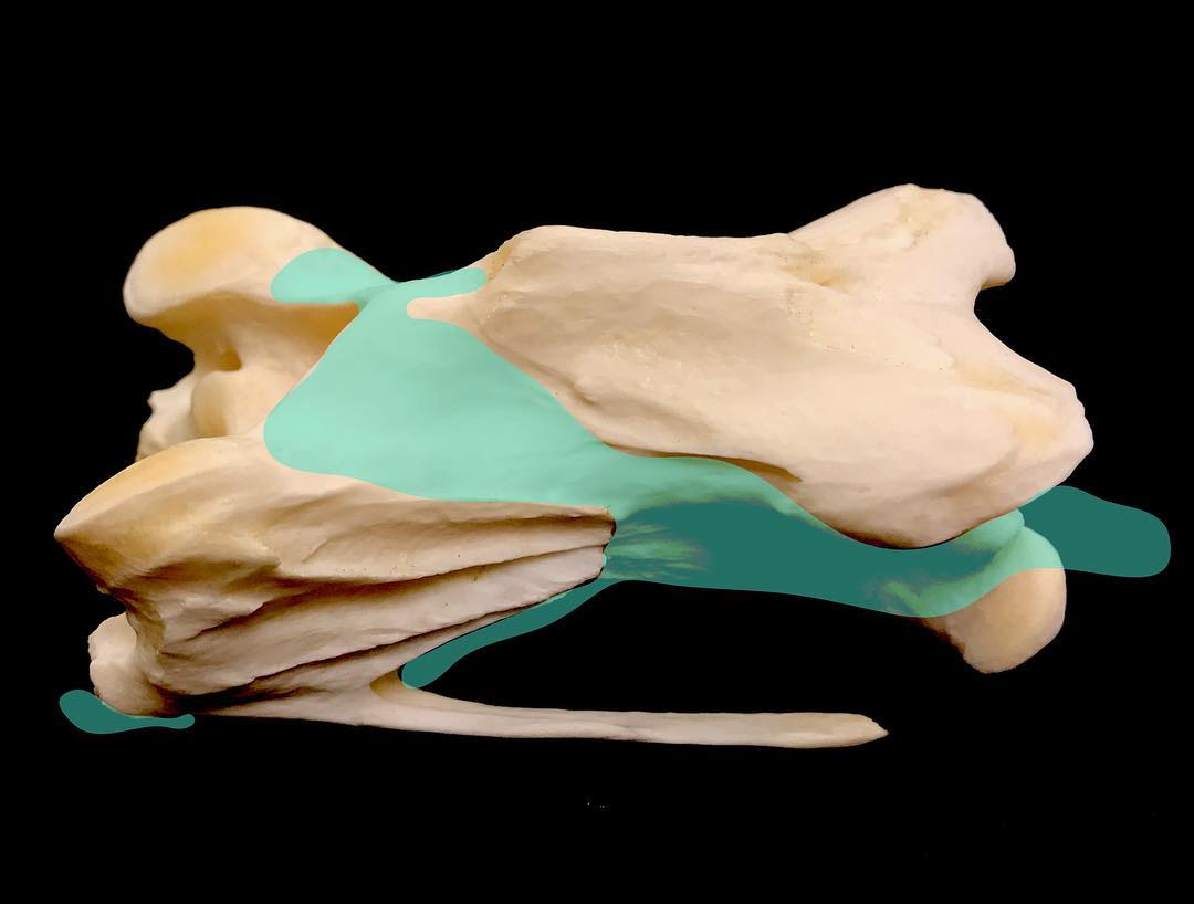 Last week I got to attend the awesome Society of Vertebrate Paleontology conference in Albuquerque (so fun and so exhausting) but now I’m back to share more weird facts about birds and the air inside of them!
.
Lately I’ve been posting about bizarre branches of the air sac system at actually enter the neural canal and contact the spinal cord. If you’re wondering how they get in there in the first place, read on!
.
This is a diagram I made showing the small air sac branches around the OUTSIDE of a vertebra. The bone you see here is a neck (cervical) vertebra from an ostrich.
.
There are two paired tubes of air that run along the side of the neck, which often go into the vertebrae at joints in between them. They also sometimes merge with other air-filled pockets on TOP of the vertebrae. These, too, sometimes bleb into the vertebral canal where the spinal cord is.
.
Basically, there is an amorphous blob of air-filled membrane wrapped around the outside of these bones, and often also going inside of them. Fun fact for the day!
.
#science #womeninstem #ostrich #bird #cervical #anatomy #livingdinosaur #teachersofinstagram #scicomm #oddity #bone #bones