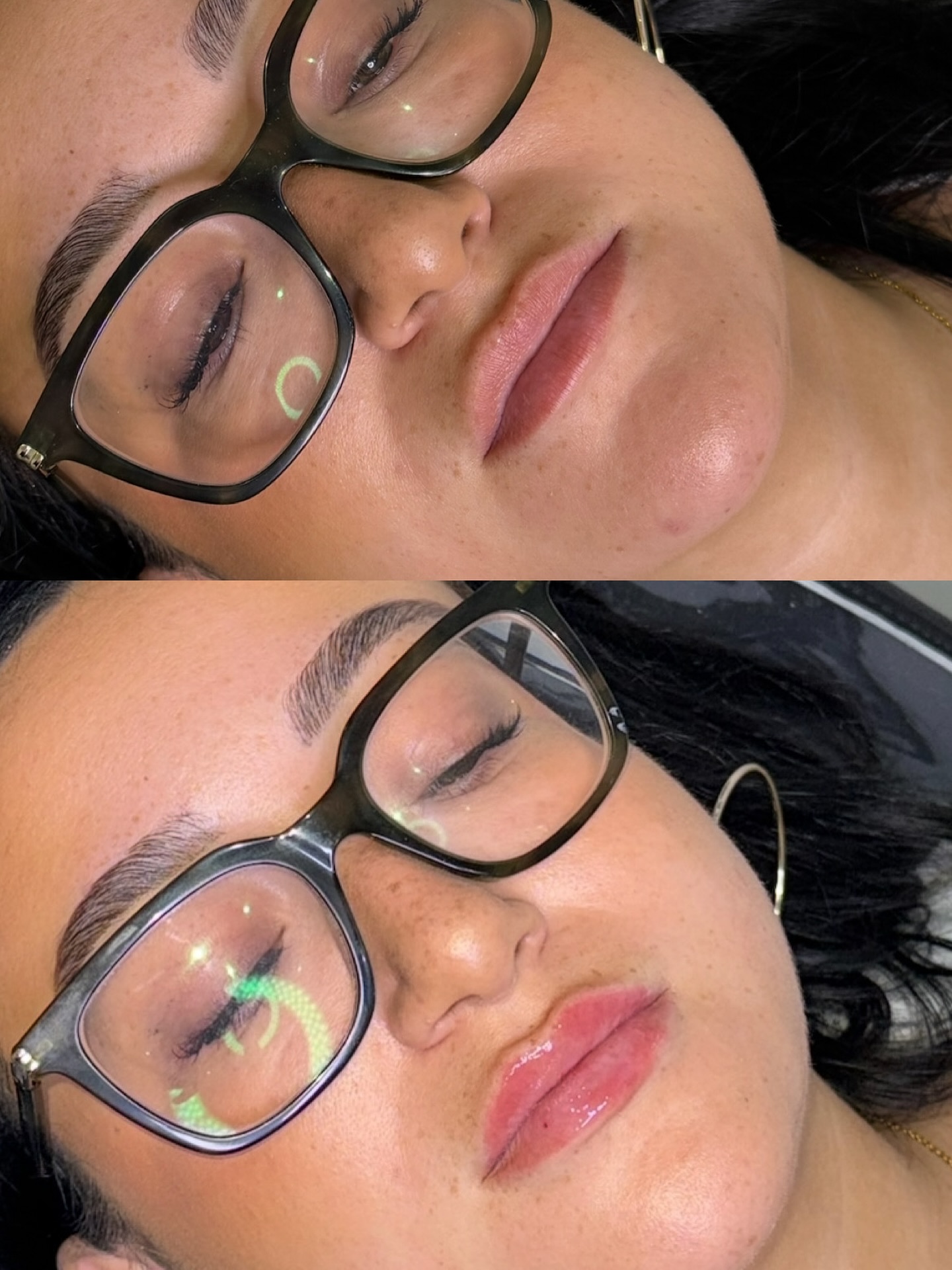 Before & After💉
Stunning lip filler for my client who come to me asking for help with symmetry✨
A little touch up to even out the shape is exactly what we did🫶🏼
#lipfiller #lipsymmetry #aesthetics #beforeandafter