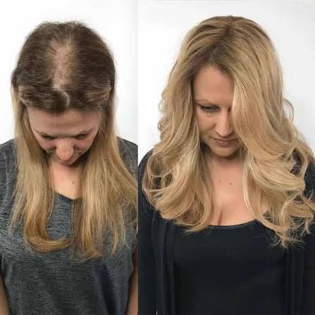 You still have a little time until February 15th to get 10% off all Hairdreams hair products.