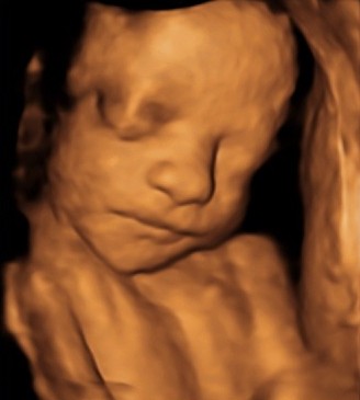 Because these moments deserve to be cherished forever🤍
Our 4D scans capture the tiny details that make your heart melt and turn them into memories you’ll treasure long after pregnancy🥰
A beautiful experience for you and your loved ones✨
Available from 26 weeks of your pregnancy🤰
📍 Nelson Scan Clinic - BabyScanUK
👉 Book your appointment today
#4DUltrasound #4DPrivateScan #PrivateScan #PrivateUltrasound #BabyScanUK