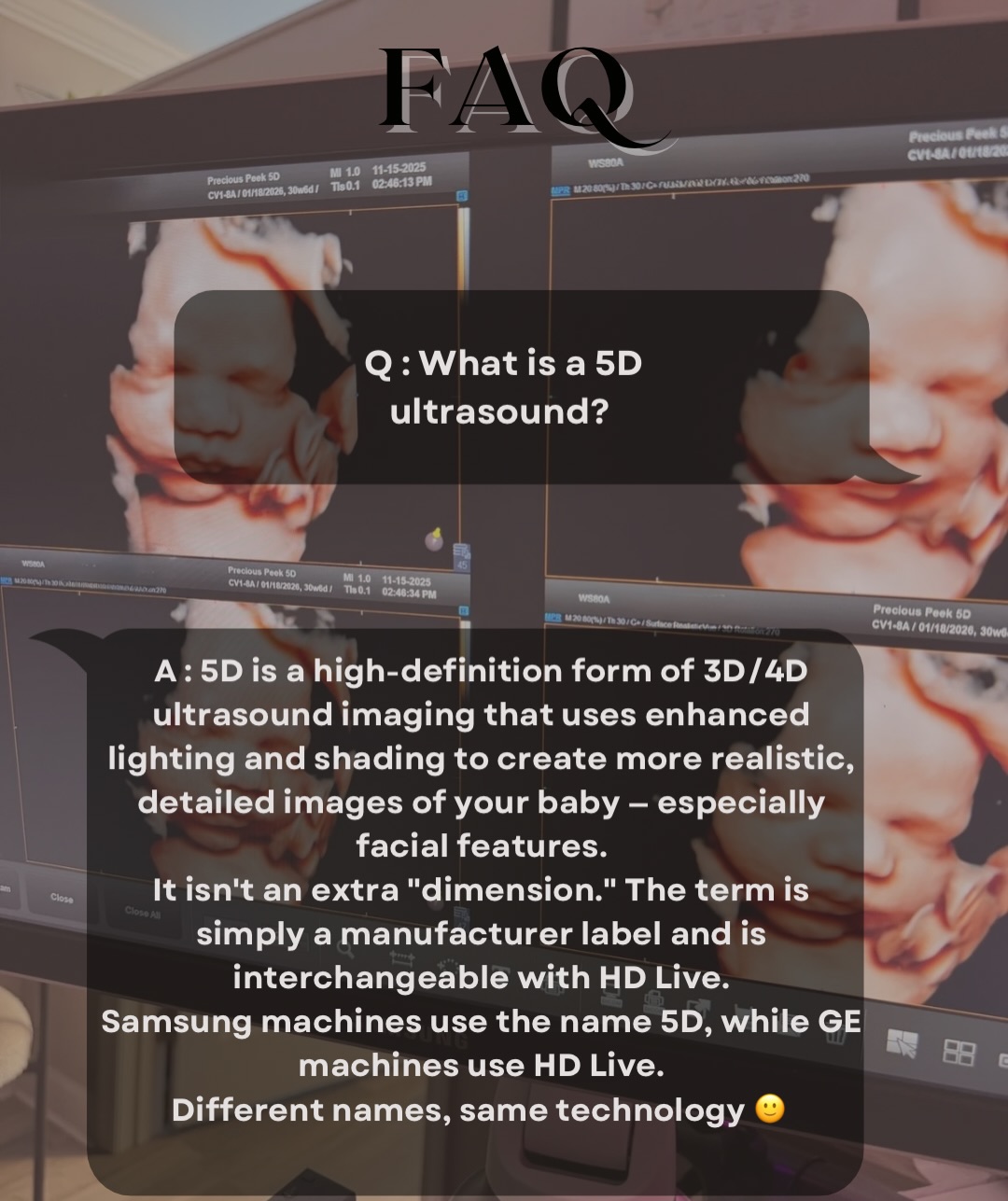 I know there’s some confusion around this… I’ve seen people say 5D is just a marketing term. It’s not It’s simply a manufacturer label for this imaging technology😊 (others call it HD Live). Same concept, different name; both can create beautiful images... and honestly skill is about 95% of it …Think Pampers vs Huggies 🤭
