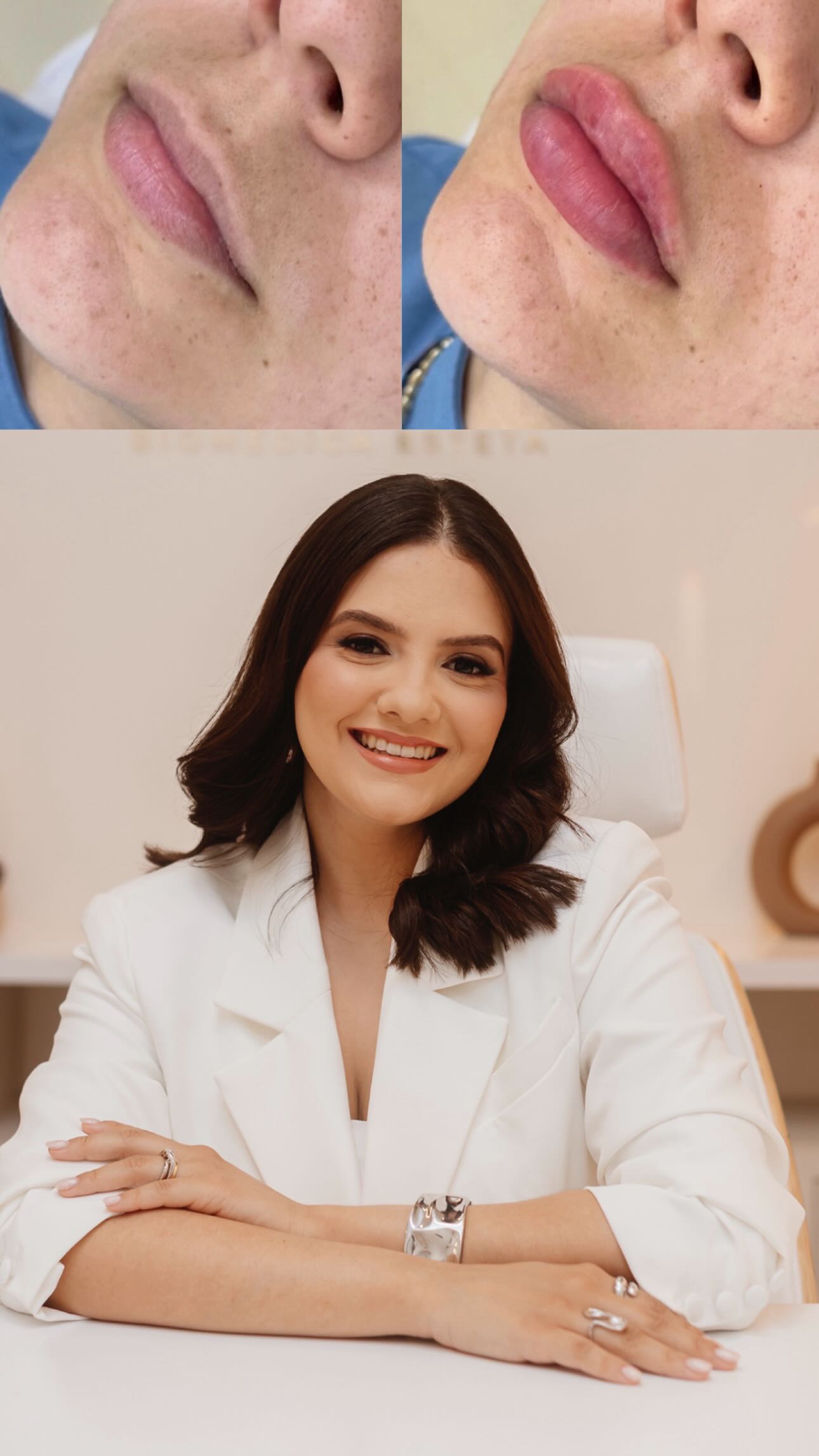 O segredo o preenchimento perfeito 💋💉
Marca logo o seu, sei que você está com vontade faz tempo 🤭
#labios