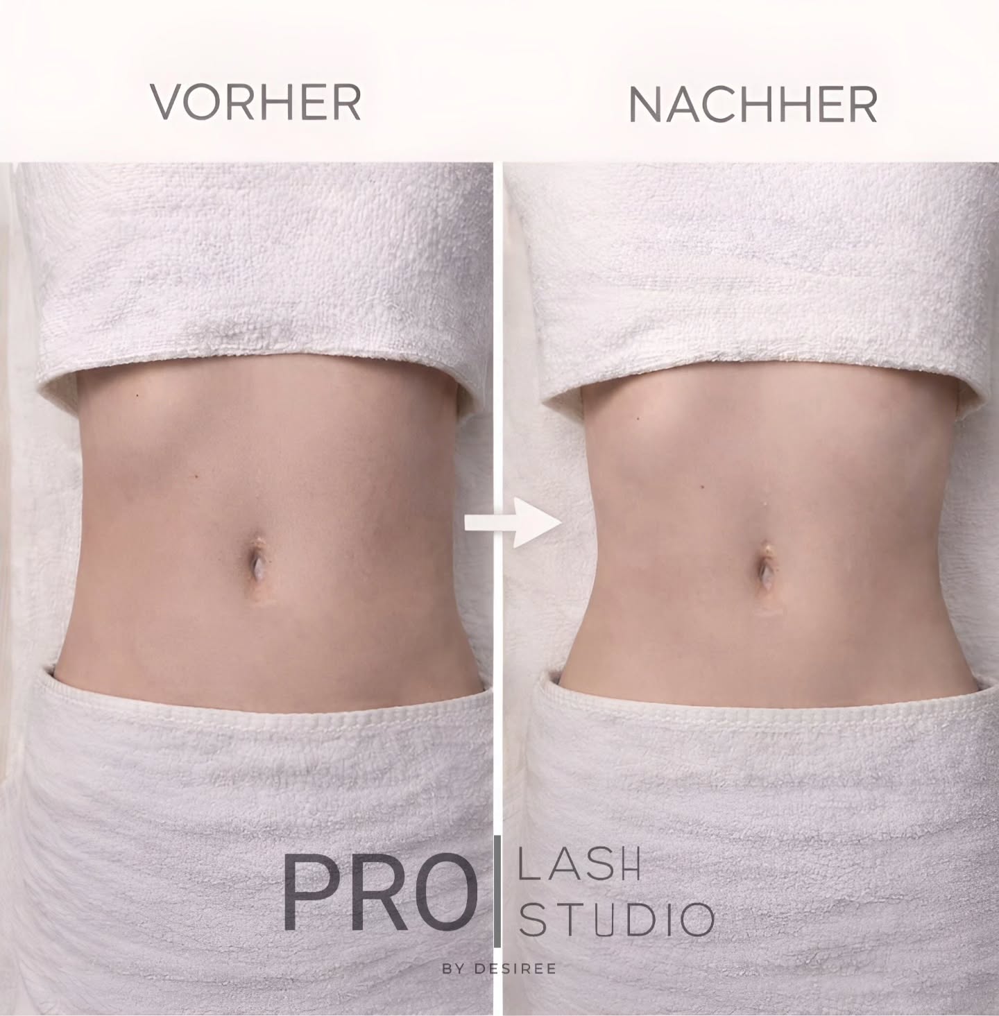 Das Ergebnis nach unserem 5-Sitzungen-Paket, durchgeführt in zweieinhalb Wochen!
➡️ Vorher ⬅️ Nachher✨️
Vereinbare JETZT deinen Termin mit Carla via
WhatsApp: +41 76 830 61 37
#bodycontouring #thun #lymphdrainagemassage #körpermodellierung #anticellulite