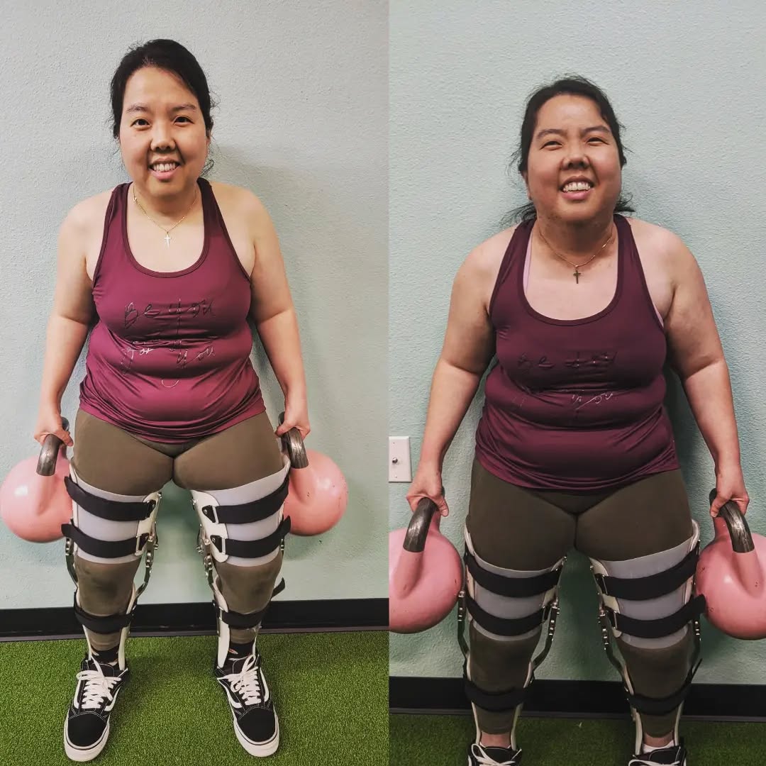 Check out our client @joanneeatstacos ~4 month progress! She started her fitness journey with a focus on asthetic goals.
She later shifted her focus on increasing her mobility and having the ability to stand upright and walk🚶♀️
She now realizes that both of those goals are not separate and we can work on BOTH at the same time. We aren't against healthy aesthetic goals and we have found that a person's functional movement goals typically line up with some of there aesthetic goals. Win win!
Here are some of Joanne's recent outcomes:
✔️ smaller waist
✔️ able to walk more upright
✔️ slimmer arms
✔️ stronger core
✔️ less back pain
✔️ better balance
Are these aesthetic or functional gains? 🤔
1️⃣What are some of your aesthetic goals?
2️⃣What are some of your functional/movement goals?
Those 2️⃣ goals may be much more related then you think!
.
.
.
#neuro #cerebralpalsyawareness #spinalcordinjury #multiplesclerosis #msawareness #multiplesclerosisawareness #strokerecovery #traumaticbraininjury #tbi #parkisons #parkisonsdisease #musculardystrophy #newportbeachca #newportbeachcalifornia #newportbeachbusiness #newportbeachphysicaltherapy #newportphysicaltherapy #physicaltherapycalifornia #costamesapersonaltrainer #motivationisthekey #inspiring #motivation #motivationmonday #motivational #motivationalvideos #motivation101 #motivationoftheday #growthmindset
