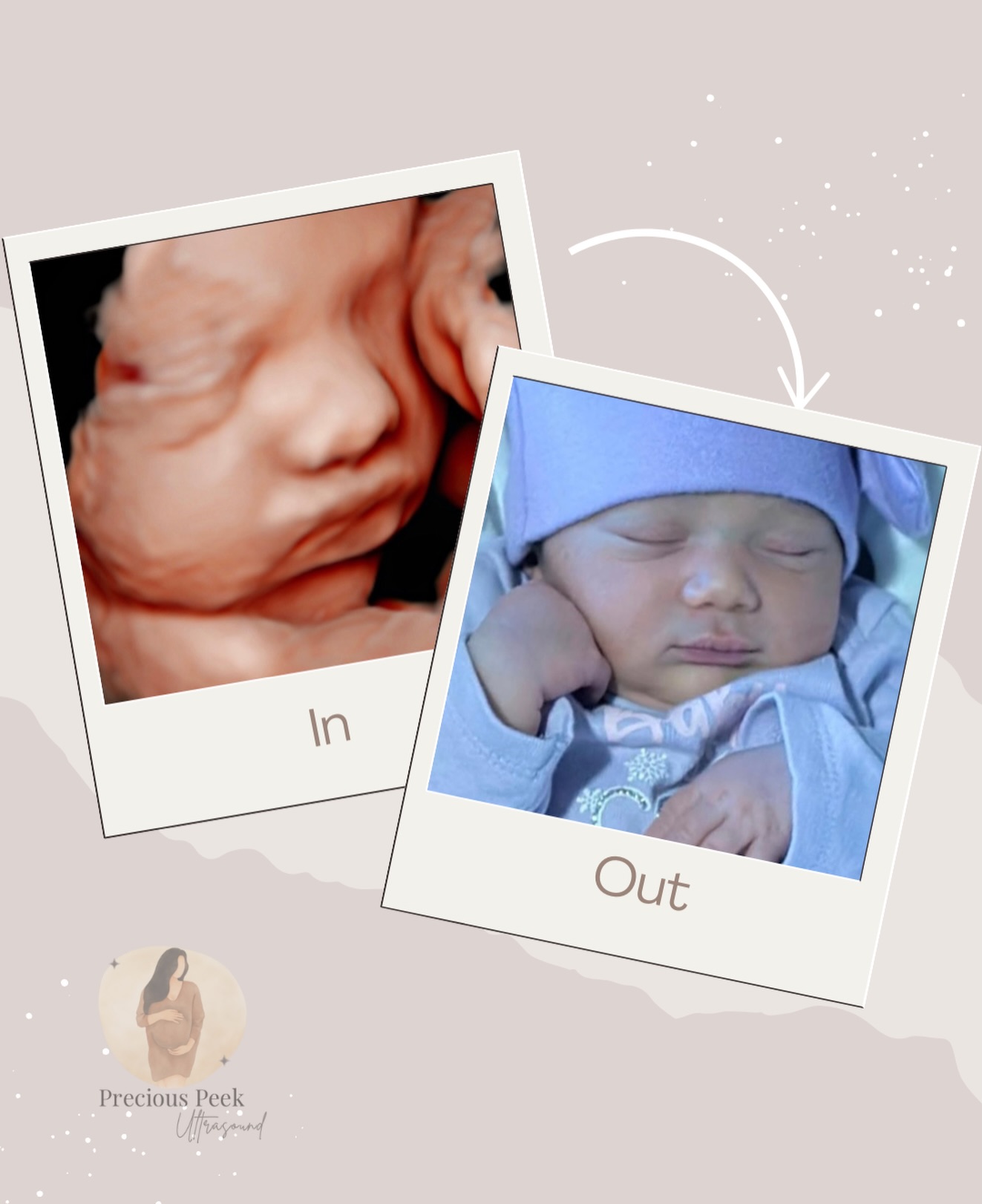 This will truly never get old…🤍
Parents always ask me, “Is this really what my baby is going to look like?”
And the answer is yes! even down to the tiniest details, the hand placement, the expressions; all of it.
Seeing how their little features translate from inside the womb to the real world is still just as amazing every single time.
Bienvenida al mundo, Kaylie!💜
Felicidades, Milli! @miliytin
Gracias de corazon por compartir este momento tan especial conmigo 🫶🥹