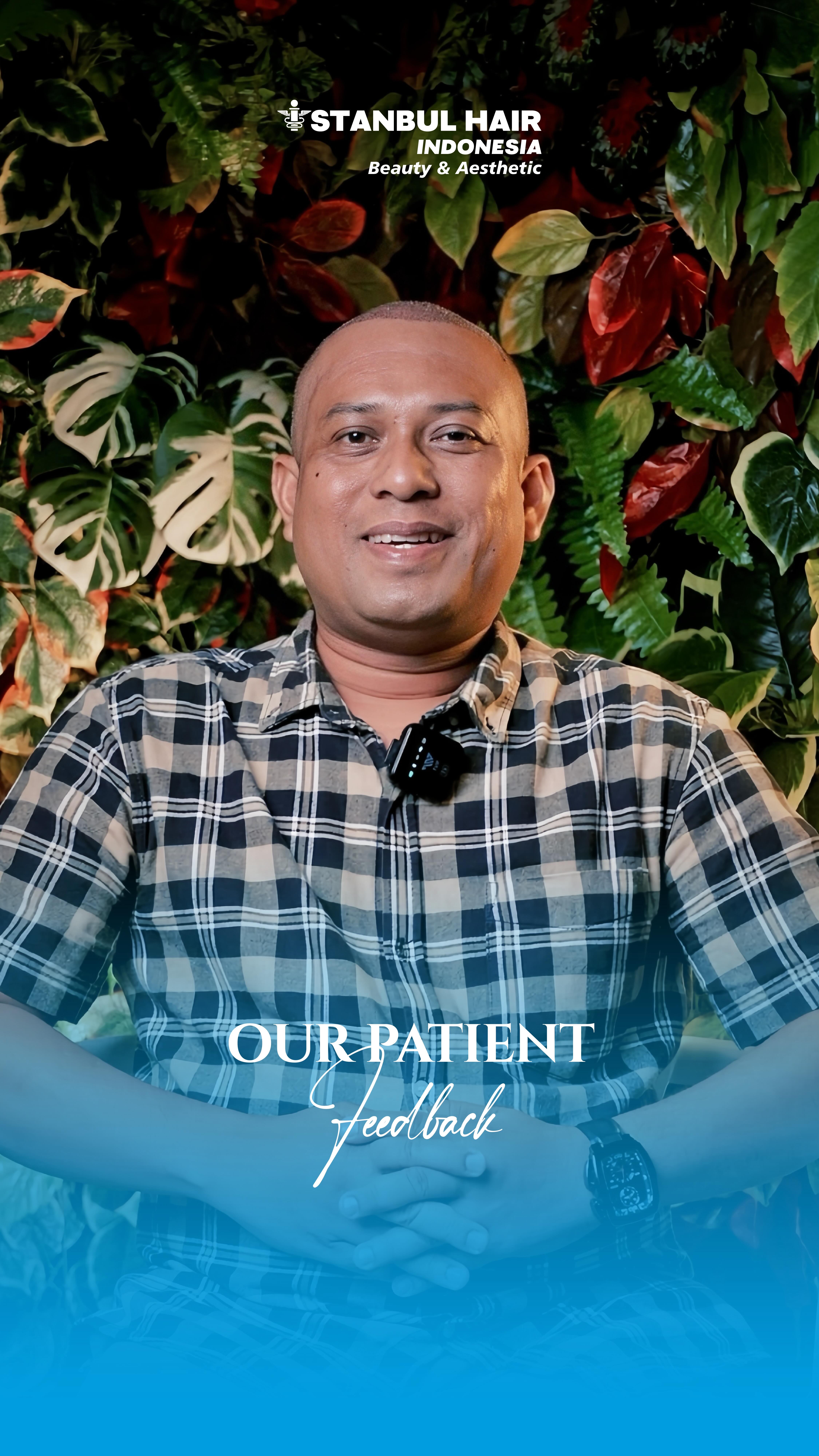 4.900 grafts — bukan sekadar jumlah, tapi representasi presisi, perencanaan, dan tanggung jawab medis.
Setiap graft dihitung dan ditanam sesuai kebutuhan area, tanpa manipulasi angka, tanpa klaim berlebihan.
Dari Kalimantan, langkah nyata menuju tampilan yang lebih proporsional dan kepercayaan diri baru.
—
4,900 grafts — more than a number, reflecting precision, planning, and medical responsibility.
Each graft is carefully counted and implanted based on real scalp needs — no inflated claims, no shortcuts.
From Kalimantan, a refined transformation toward a balanced look and renewed confidence.
#IstanbulHairIndonesia #HairTransplant #4900Grafts #RealResults #MedicalPrecision