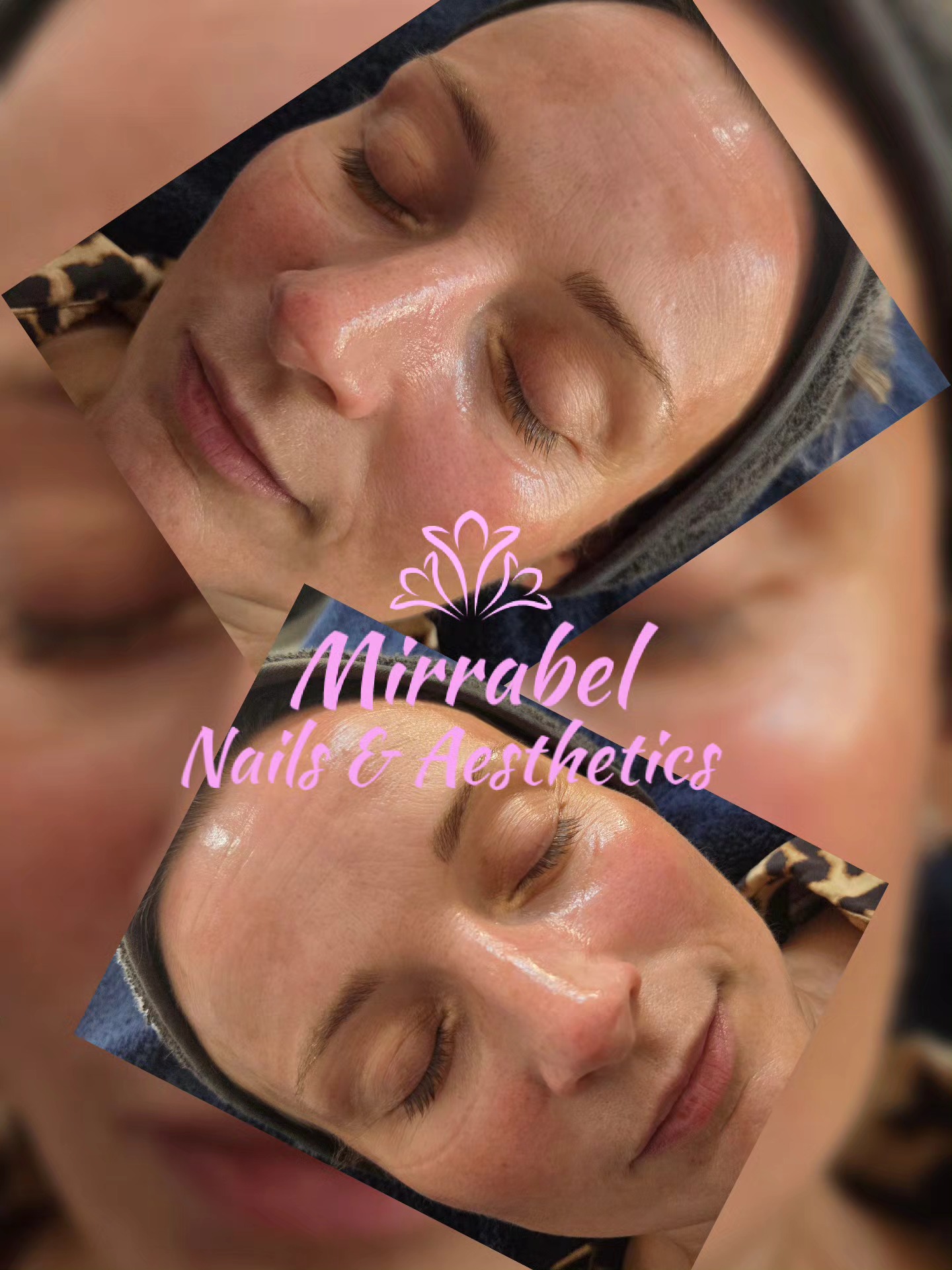 Rejuvenate your appearance and start fresh with healthy skin.
Hydro ultimate facial offers numerous benefits for skin, including deep cleansing, exfoliation, hydration and improved texture. It can help with issues like clogged pores, fine lines, wrinkles, and uneven skin tone, ultimately promoting a healthier, more radiant complexion.
#hydrofacial
#Altrinchamtoday #Hale #facialtreatment #skin #cloggedpores #dryskin #glowingskin #Wythenshawe #timperleybeauty #facial