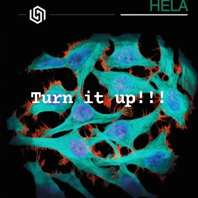 First single incoming! HeLa from Hexajinn's new EP, Encounter, now everywhere you get music.
https://open.spotify.com/album/1TOYFay7XQU0Sa4xdCh2ja?si=TR-WHHq6TOGU0nMpElgrAw
#metaldrummer #metal #metalmusic #hexajinn #numetal