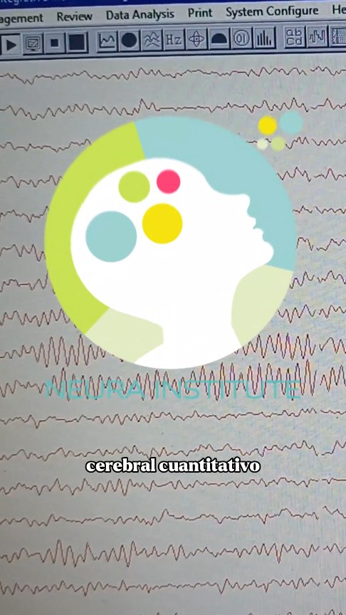 🧠 En Neura Institute no adivinamos diagnósticos. Los construimos con evidencia.
Cada persona es distinta, por eso nuestro diagnóstico no se basa en una sola prueba ni en suposiciones.
Integramos: ✔️ Mapeo cerebral
✔️ Tomografía LORETA
✔️ Evaluaciones neuropsicológicas
✔️ Pruebas en realidad virtual (cómo funciona el cerebro en situaciones reales)
Con esa información diseñamos un plan personalizado, que puede incluir: 🔹 Neurofeedback
🔹 Neuromodulación (estimulación transcraneal no invasiva)
🔹 Psicoterapia
🔹 Enlace y seguimiento con psiquiatría cuando es necesario
Todo dentro de un modelo interdisciplinario, dirigido por profesionales con más de 25 años de experiencia clínica.
📌 Porque entender tu cerebro es el primer paso para tratarlo mejor.
💬 Si esto te hizo sentido, guárdalo, compártelo o comenta acá.
www.neurainstitute.com