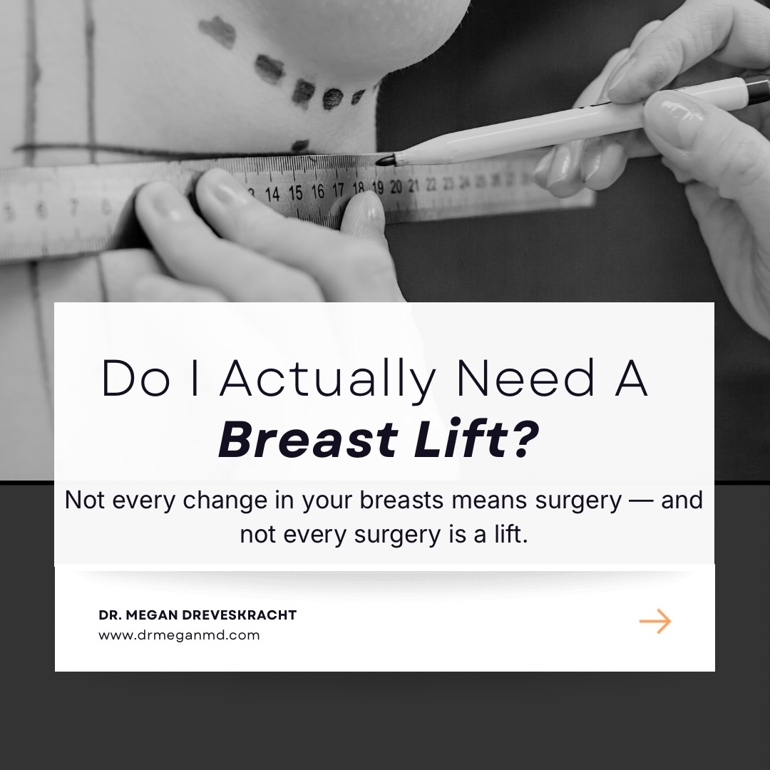 Schedule your consultation today ⬇️
⌨️ www.drmeganmd.com ☎️206.860.5582 📍 Downtown Seattle, Washington
#breastlift #doctor #femaleplasticsurgeon #seattleplasticsurgery