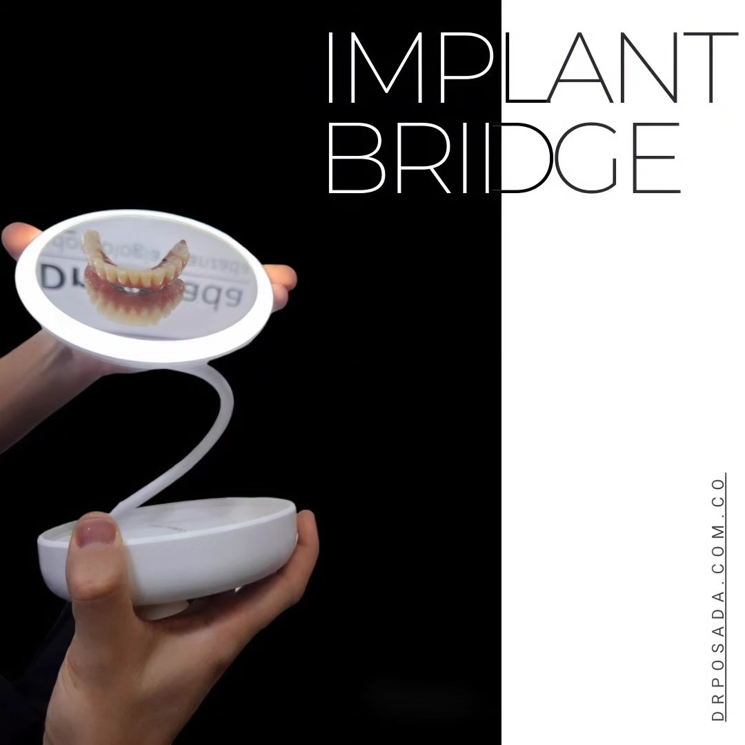 "Unlock the smile of your dreams with our cutting-edge hybrid dental prosthesis! Say goodbye to worries and hello to confidence. #SmileBright #DentalInnovation"
.
.
.
.
.
.
.
.
.
.
.
📲 3046529022
📞6016529022