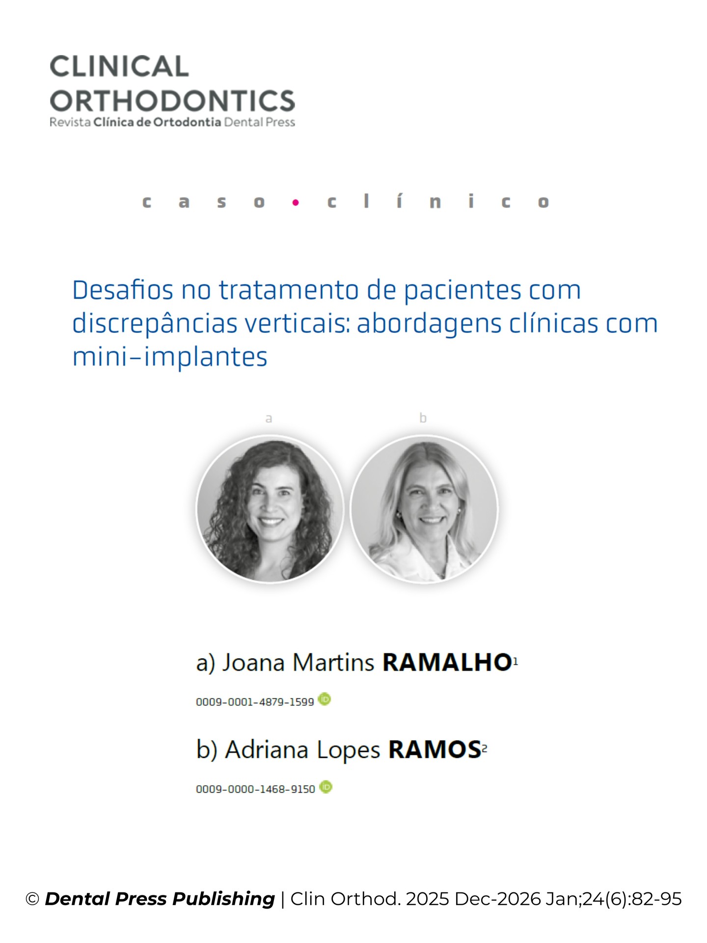 📖 Artigo científico publicado
Com enorme satisfação, partilho a publicação do nosso artigo
“Desafios no tratamento de pacientes com discrepâncias verticais: abordagens clínicas com mini-implantes”
na revista Clinical Orthodontics | Dental Press.
Este trabalho representa muito do que acreditamos na prática clínica diária: enfrentar casos desafiantes com raciocínio biomecânico sólido, ancoragem esquelética bem indicada e foco em soluções previsíveis. Em ambos os casos, foi possível melhorar significativamente a oclusão e a estética, evitando a necessidade de cirurgia ortognática.
É um orgulho ver este trabalho publicado e contribuir para a discussão científica sobre tratamentos mais conservadores, eficazes e baseados em evidência.
🦷📚