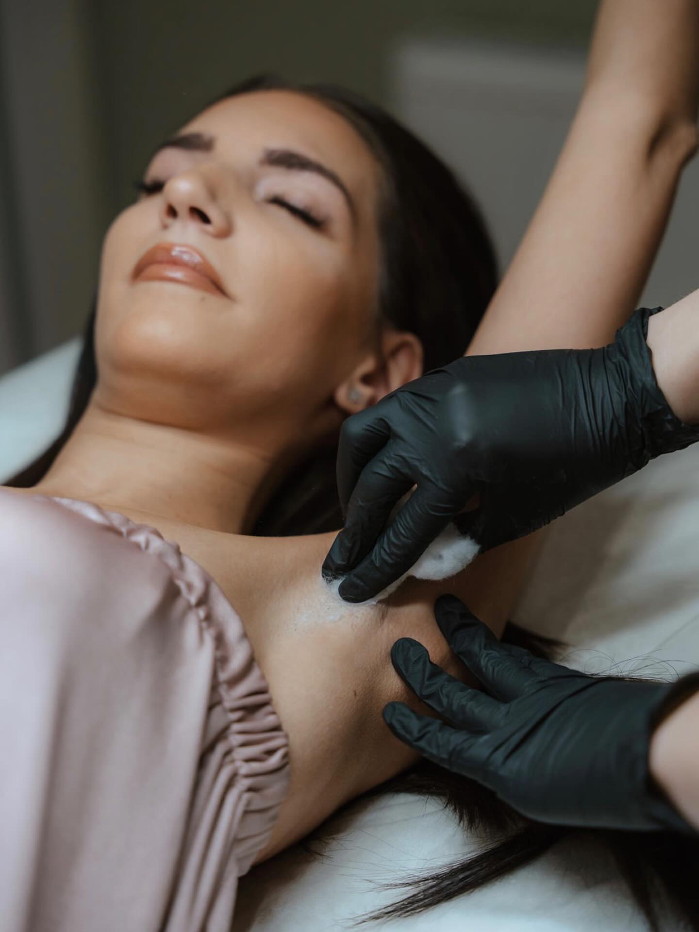 Hónalj gyantázás – fokozott odafigyeléssel 🤍
A hónalj különösen érzékeny terület, ezért a kezelés nálunk mindig körültekintő bőrvizsgálattal kezdődik.
🔍 Mire figyelünk hónalj gyantázás előtt és közben?
▫️ Bőrelváltozások, sérülések:
Sebek, gyulladás, kipirosodás vagy irritált bőr esetén az adott területet kihagyjuk, mert a gyantázás ronthatja a bőr állapotát.
▫️ Anyajegyek ellenőrzése:
Kiemelkedő vagy érzékeny anyajegyek környékén nem dolgozunk, ezeket mindig kikerüljük.
▫️ Bőrtípus és érzékenység:
A hónalj bőre vékony és érzékeny, ezért a megfelelő gyantát és technikát választjuk, a bőr állapotához igazítva.
▫️ Szőrnövekedés iránya:
A hónalj területén a szőr több irányba nő, ezért a kezelést részletekben végezzük, a növekedési irányt figyelembe véve.
Ez segít megelőzni a beszakadt szőrszálakat és a bőrirritációt.
▫️ Izzadás, dezodorhasználat:
👉 Kezelés előtt közvetlenül, valamint a gyantázást követő 24 órában ne használj dezodort, mert a pórusok ilyenkor nyitottabbak, és a dezodor irritációt okozhat.
A kezelés előtt az esetleges dezodormaradványokat is figyelembe vesszük a biztonságos és hatékony gyantázás érdekében.
👉 A gyantázást követően 24 óráig az edzést is érdemes kerülni, mert az izzadás irritálhatja a frissen kezelt bőrt.
💬 Vendégkommunikáció:
Minden kezelést egyeztetés előz meg, és szükség esetén tanácsot adunk az utóápolásra is.
✨ Precíz, kíméletes gyantázás – a bőr egészsége nálunk az első.
#honaljgyantazas #gyantazas #szortelenites #professzionalisgyantazas #szakmaimunka