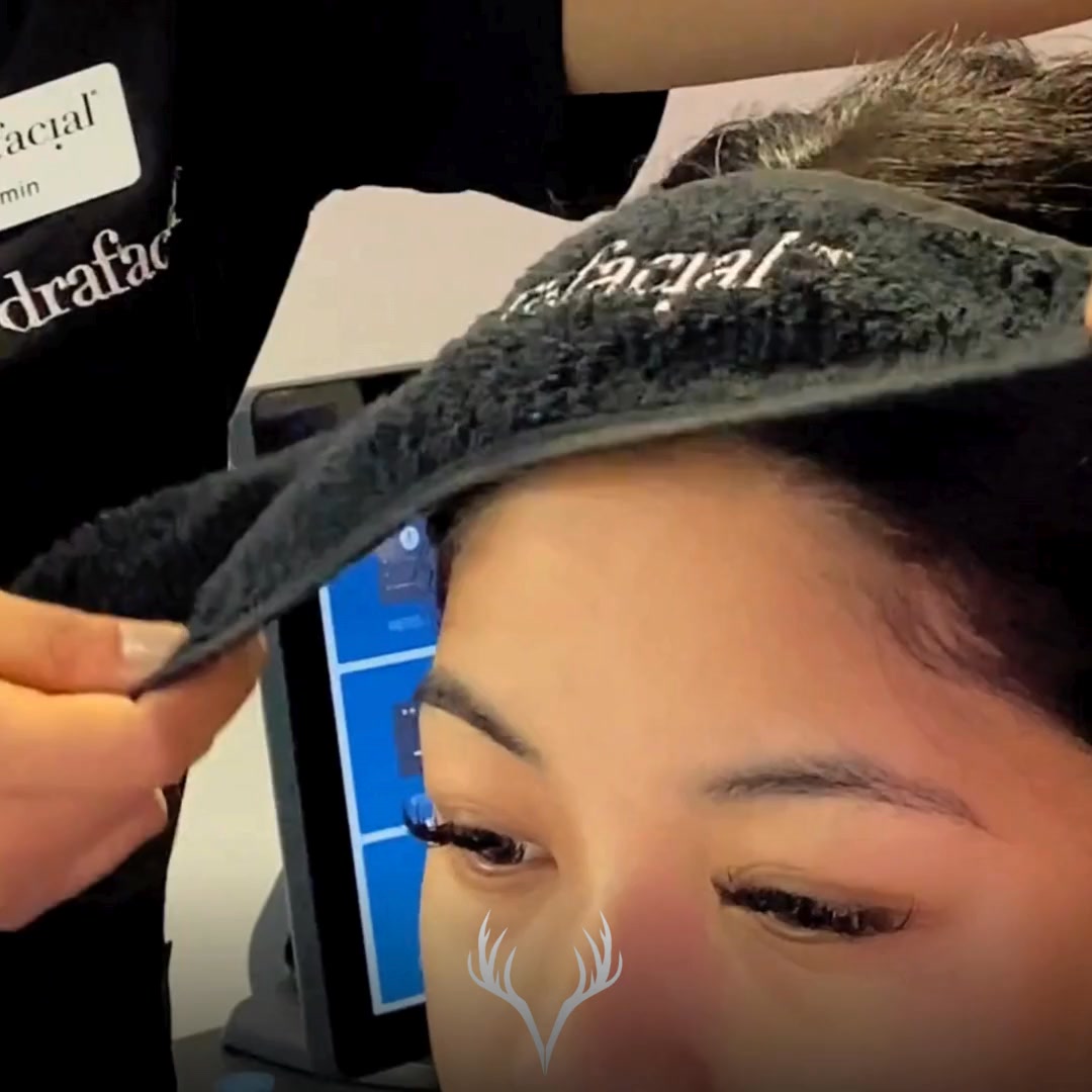 ✨ Was bei unseren Hydrafacial-Behandlungen immer inklusive ist ✨
Hydrafacial ist bei uns keine Standardbehandlung, sondern wird jedes Mal individuell auf deine Haut abgestimmt.
🔍 Kurze Consultation vor jeder Behandlung
Vor jedem Hydrafacial nehmen wir uns kurz Zeit für eine gezielte Einschätzung deines aktuellen Hautzustands:
– Wie fühlt sich deine Haut heute an?
– Gibt es Spannungsgefühle, Unreinheiten oder Rötungen?
– Was braucht deine Haut genau jetzt?
👉 Diese kurze Consultation dient ausschließlich der tagesaktuellen Anpassung der Behandlung und ist keine ausführliche Hautanalyse.
💧 Individuelle Personalisierung des Hydrafacials
Basierend auf dieser Einschätzung passen wir dein Hydrafacial an:
– Intensität der Reinigung
– Auswahl der Wirkstofflösungen
– sanfte oder intensivere Schritte
– passende Add-ons je nach Hautzustand
✨ Wichtig zu wissen:
Eine ausführliche Hautanalyse (Observ) ist bei uns
✔️ vor der 1. Behandlung
✔️ und vor jeder 4. Behandlung
kostenlos inkludiert.
So stellen wir sicher, dass deine Haut langfristig korrekt begleitet wird – und gleichzeitig jede einzelne Behandlung optimal auf deinen aktuellen Hautzustand abgestimmt ist.
📍 Hydrafacial in Baden – individuell & professionell
📞 Termine bitte telefonisch oder über unser Online-Buchungstool
Beauty Bar Baden
#hydrafacialbaden #personalisiertehautpflege #hautconsultation #beautybarbaden #facialbaden #skincarebaden #clearskin #glowingskin