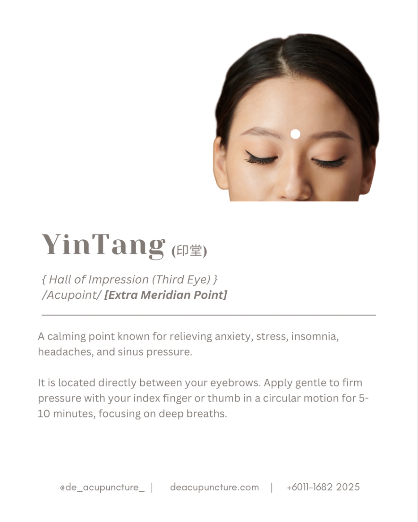 Got a STRESS Headache? 🤯
Press HERE to Feel Better FAST!
Always feeling tension between your eyes 👀? Like your brain is full of fog and your mind just won’t STOP racing? 😫 This is your body screaming for a time-out!
In TCM, we have a secret weapon against this: the Yin Tang (印堂) acupoint, located right in the center of your eyebrows. Literally translating to the “Hall of Impression,” this point is legendary for calming your Shen (Spirit). ✨
When we needle (or simply press!) Yin Tang, it helps:
🔸Stop the Racing Mind
🔸Relieving tension headaches, dizziness, and the heavy feeling of sinusitis.
🔸Promote Sleep
You can try it now! Use your thumb or finger and gently massage the point for 30 seconds while taking deep breaths. You might feel a wave of calm wash over you! 🌊
BUT—here’s the key part: While acupressure on Yin Tang is a great self-care hack, if your anxiety or headaches are constant, it means the root cause of your internal imbalance is deeper. It could be Liver Qi Stagnation, Heart Fire, or Kidney deficiency! 😱
Have you been pressing this point for weeks with no long-term relief? Tell us in the comments! 👇
That’s why self-care alone is not enough. Consult our qualified TCM practitioners at 医心医意中医坊 De Acupuncture x Herbs Centre first. We use Yin Tang alongside a tailored set of body points and custom herbal formulas to address the true cause of your stress and insomnia, giving you lasting peace. 💖 We are located right here in Subang Jaya, USJ area! 📍
Ready to turn off the mental noise?
Click the link in our bio to book your consultation today! 📌
#YinTang #Acupressure #TCM #StressRelief #AnxietyRelief #InsomniaCure #HeadacheRelief #TCMTips #Acupuncture #医心医意中医坊 #SubangJayaTCM #USJ #SubangJaya #HolisticHealth #CalmTheShen