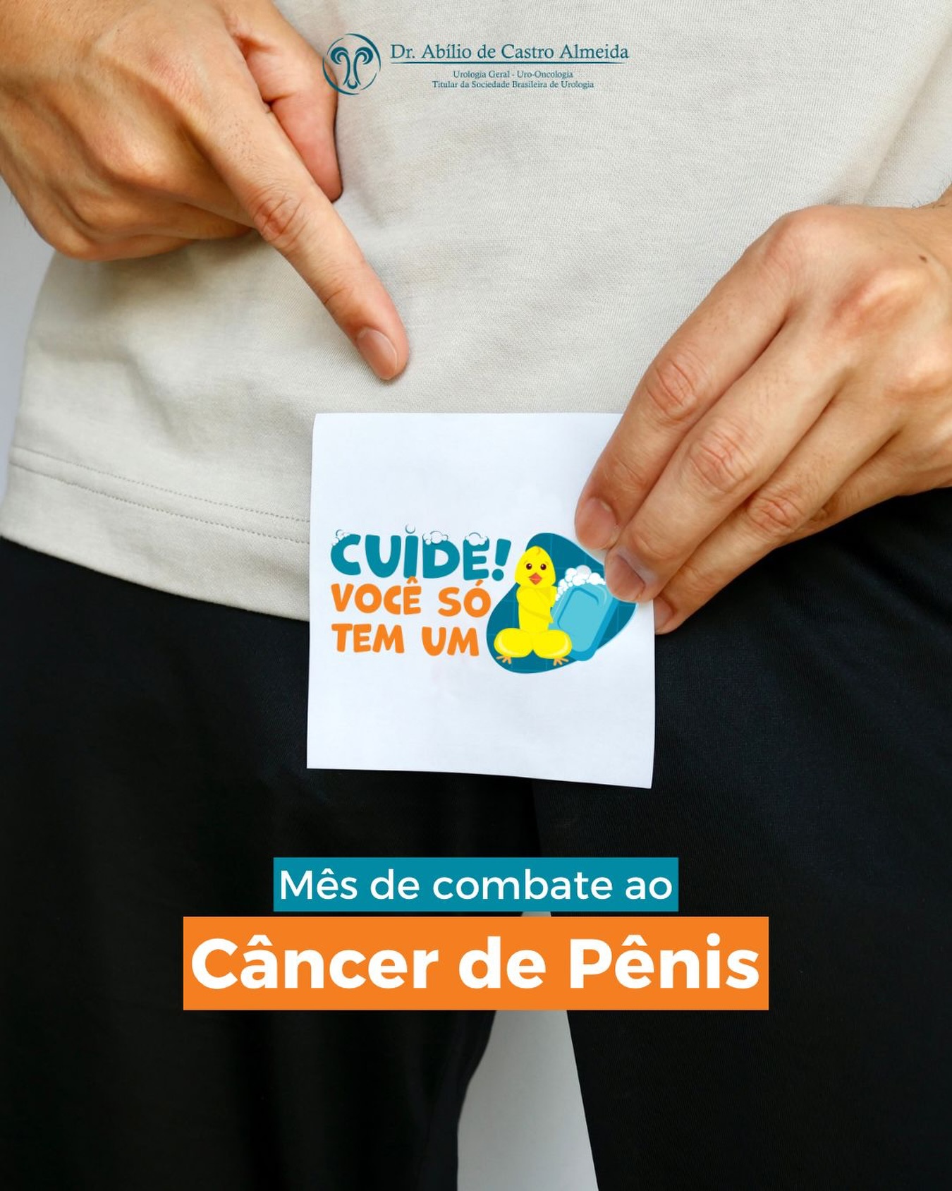 O câncer de pênis é raro, mas pode ser prevenido e tratado quando diagnosticado precocemente.
⚠️ Fique atento aos sinais:
• Feridas que não cicatrizam
• Lesões, manchas ou verrugas no pênis
• Mau cheiro persistente
• Dor ou sangramento
🧼 A prevenção começa com cuidados simples:
✔️ Higiene íntima adequada
✔️ Uso de preservativo
✔️ Vacinação contra o HPV
✔️ Acompanhamento urológico regular
👉 Cuidar da saúde íntima também é um ato de responsabilidade e amor-próprio.
📲 Em caso de qualquer alteração, agende uma consulta.
#CuideVocêSóTemUm #CâncerDePênis #SBU #Urologia #SaúdeDoHomem