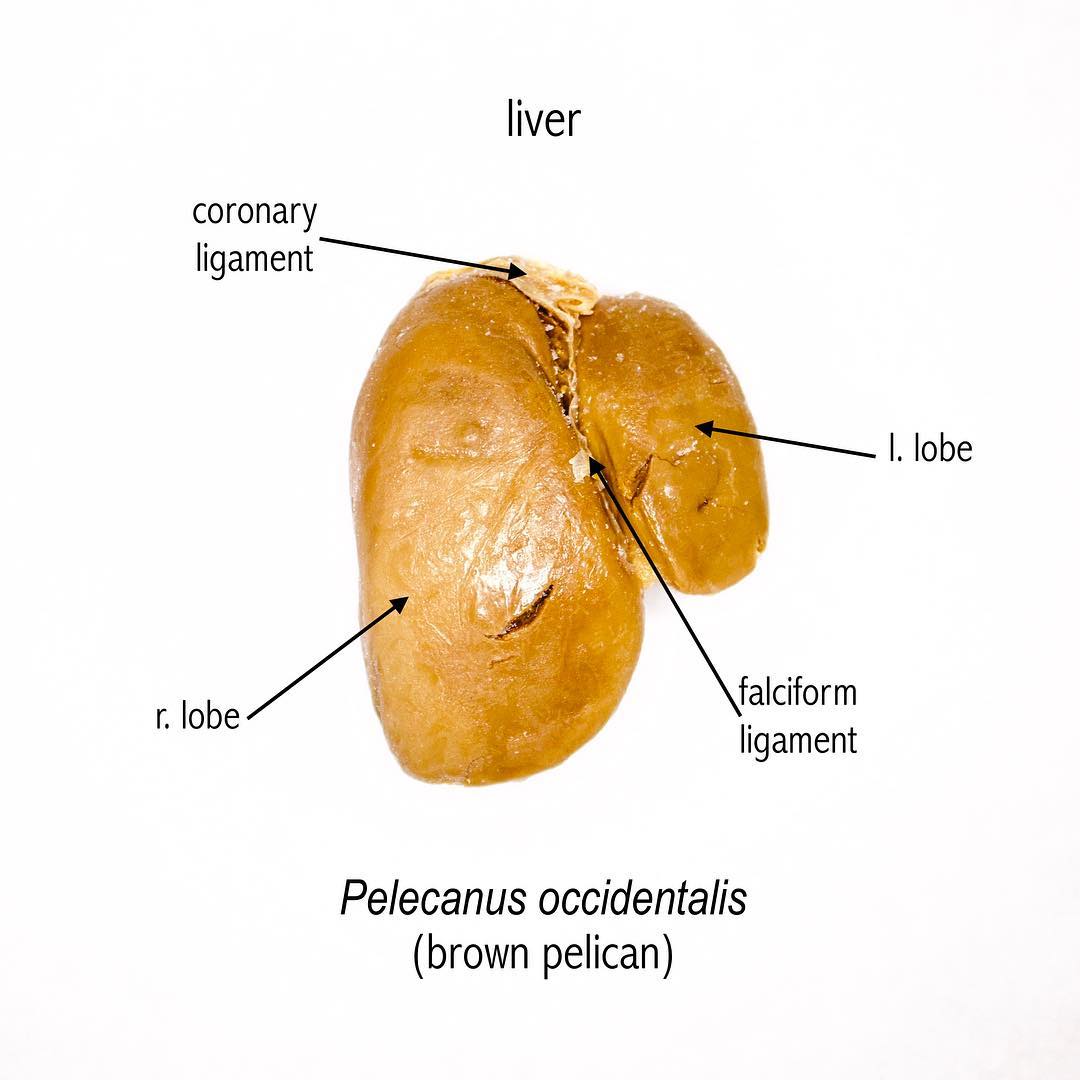 And here’s a closeup of that #plastinated #pelican #liver. Bird livers are made up of two lobes, a right and a left, with the right lobe being the larger of the two. I’m always fascinated by the lobi-ness of livers. Some animals have five or six lobes (for instance, I’ve seen many in a rat liver)! This organ is connected via the hepatic vein to the stomach, intestine, and spleen.
.
The coronary and falciform ligaments are what hold up this organ in the abdominal cavity, attaching it to the body wall anteriorly (falciform) and to other internal structures cranially (coronary). It’s actually very similar to the anatomy of our own liver!
.
#anatomy #macabre #birdanatomy #dead #plastinating #plastination #science #scienceart #liver #comparativeanatomy #digestivesystem #teachersofinstagram #womeninscience #ladyscientist