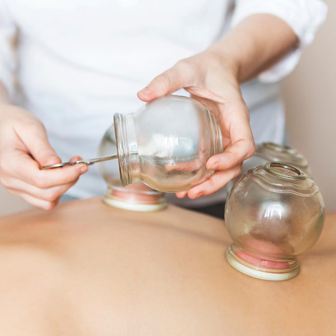 Cupping is a great way to improve circulation and release muscle tension! The cups create a vacuum which decompressed the tissues to allow for blood flow and healing! There’s a blog post up on my site if you are curious to learn more!