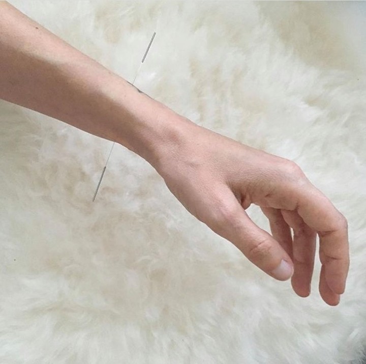 ACUPUNCTURE vs. HERBAL MEDICINE 🌿
Both acupuncture and herbs are used synergistically to nourish, cleanse, detox, warm, cool, ground and uplift the mind and body.
Herbal medicine is supplementary. The properties of the herbs aids the body to restore homeostatic balance.
Acupuncture embraces the body’s own ability to rebalance itself into homeostasis. Specifically chosen points that are suitable for you are needled to reignite your body’s natural rebalancing abilities.
While doing either acupuncture and herbs are beneficial in their own ways, using both during treatments tend to amplify the healing process.