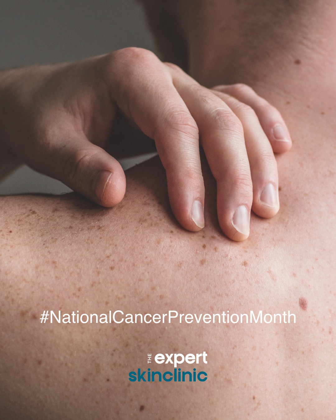 February is National Cancer Prevention Month.
Cancer prevention is something we’re extremely passionate about at The Expert Skin Clinic, especially skin cancer prevention.
Skin health is at the forefront of everything we do. Through our founder Larissa’s personal experience with skin cancer, and our mole and blemish screening service - we’ve been spreading awareness for skin cancer for a while now, teaching people how you can protect and prevent your skin.
Throughout the month, we’ll be sharing more resources, and information on what you can do to protect your skin.
#NationalCancerPreventionMonth #CancerPrevention #SkinCancer #MoleMapping #SkinCancerPrevention #SkinCancerAwareness