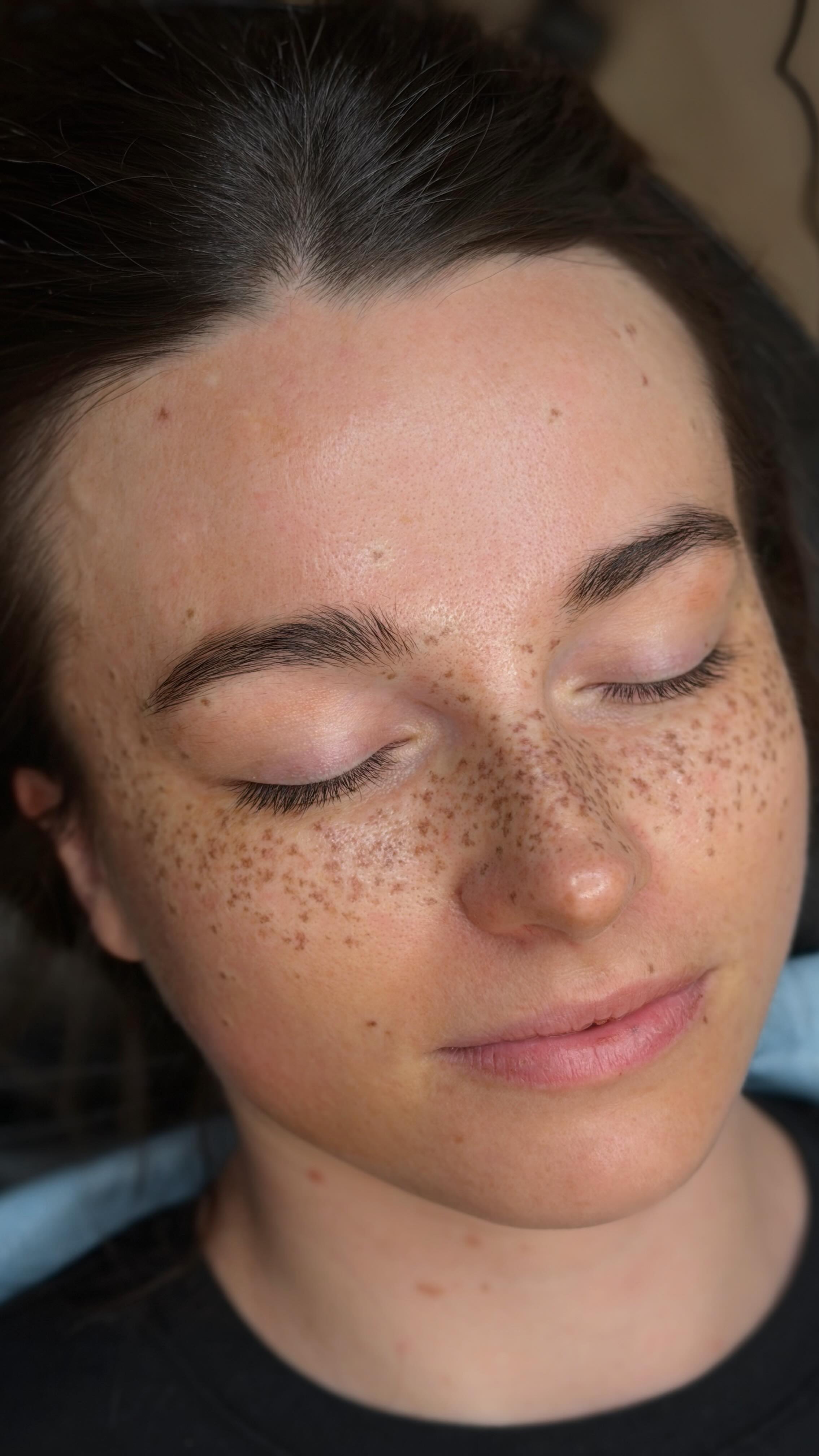 This gorgeous client has been coming in over the course of a year to slowly add and layer her freckle tattoos. Sadly she’s moving, so we did one last extreme coverage session to hold her over until she can visit again!
#freckletattoo