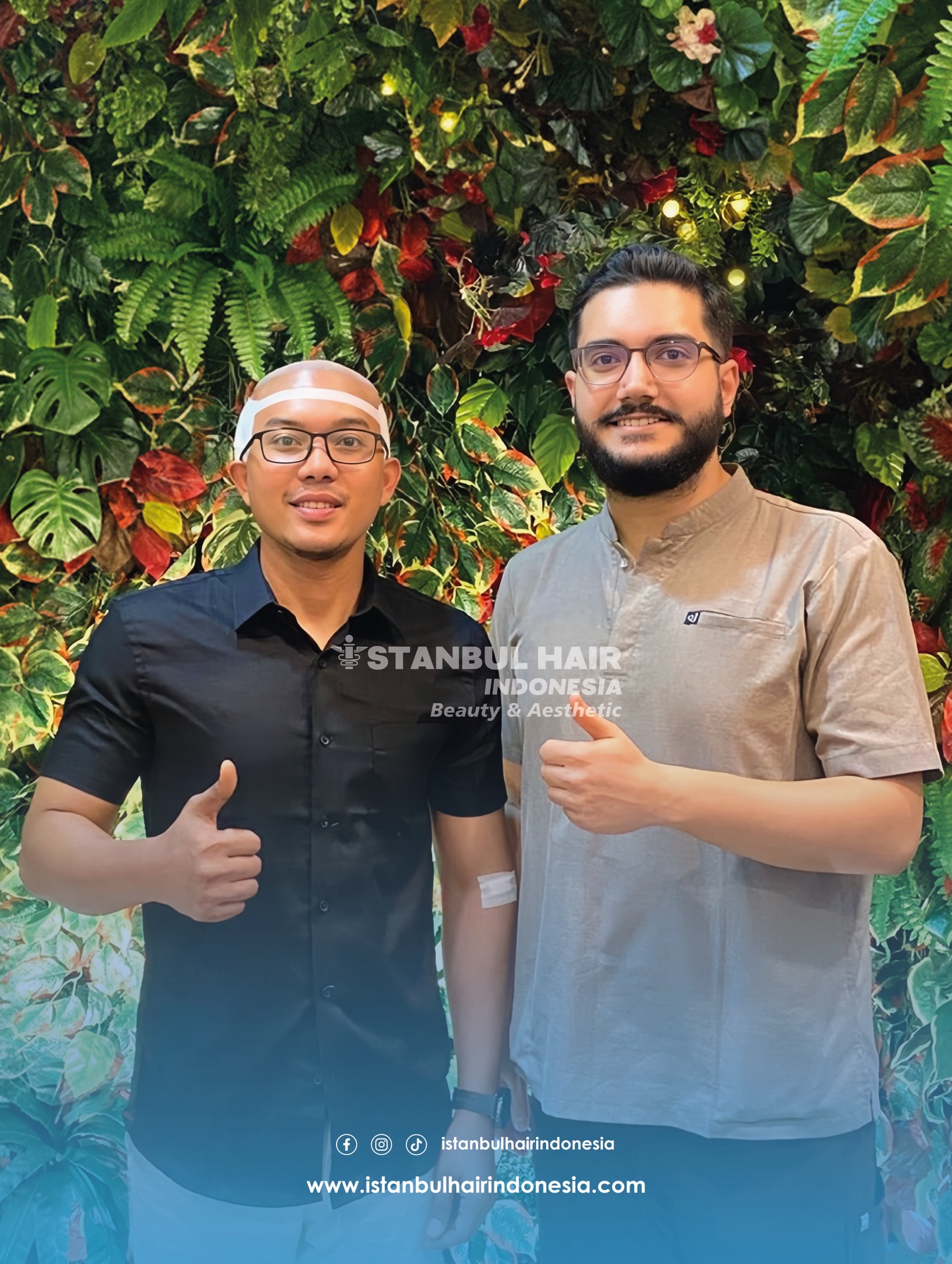 Dari Aceh, sebuah keputusan besar untuk perubahan yang nyata. ✨
Sebanyak 4.100 graft ditanam dengan presisi tinggi dan standar medis terbaik — menghadirkan hasil yang natural, padat, dan proporsional. Tanpa klaim berlebihan, tanpa angka yang dibesar-besarkan.
From Aceh, a big decision for a real change. ✨
A total of 4,100 grafts were implanted with high precision and top medical standards — delivering natural, dense, and proportional results. No exaggerated claims, no inflated numbers.
#IstanbulHairIndonesia #HairTransplantIndonesia #4100Grafts #RealTransformation #TrustedClinic