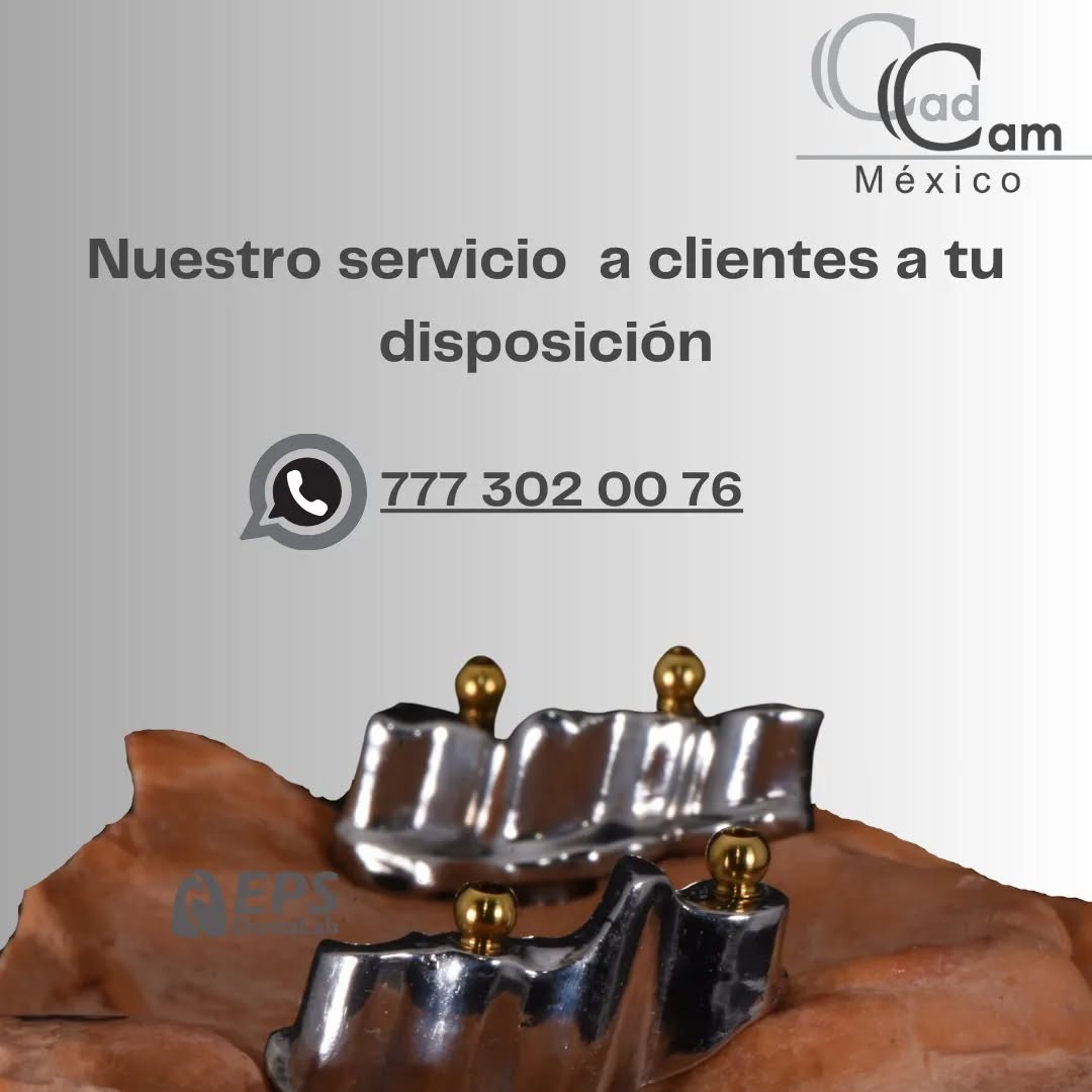 Barras de Titanio con retención EPS Ball para Removible All on 4. Ponte en contacto con nosotros y con mucho gusto diseñaremos y fabricaremos tu trabajo. Manda tu trabajo y archivos STL. a info@cadcam-mexico.com - - -
Aviso de responsabilidad: Todas las fotos publicadas en esta cuenta de Instagram son propiedad intelectual de Estudio de Porcelana Suizo S.A de C.V. y están protegidas por derechos de autor. #CadCam #Mexico #Cromocobalto #implantologia #implantesdentales #dentistry #dentista