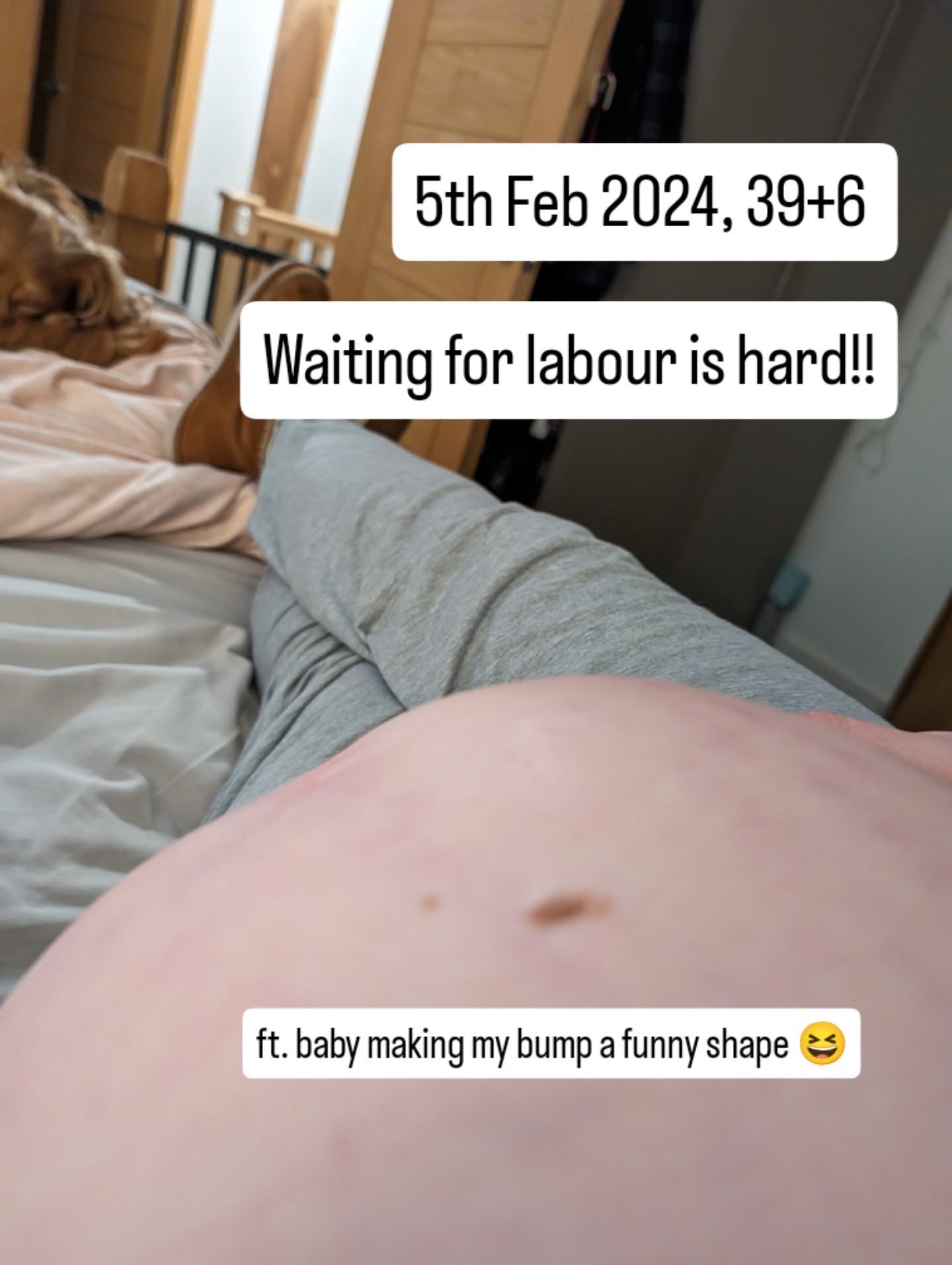 Waiting for labour can be hard, no matter how positive and patient your trying to be.
My first birth was 40+6 and yet I was still convinced he might come early 🙈
I knew I wouldn't want an induction for simply being 'overdue' and I was very happy with my decision. But it's still hard to wait as your due date comes and goes and you're uncomfortable so I really had to practice what I preach and trust that things would happen when my body was ready 😆
Maxie is 2 next week...he kept me waiting another 6 days after this photo 🥰
#positivebirth
#homebirth #40weekspregnant #hypnobirthinglichfield #hypnobirthingburntwood