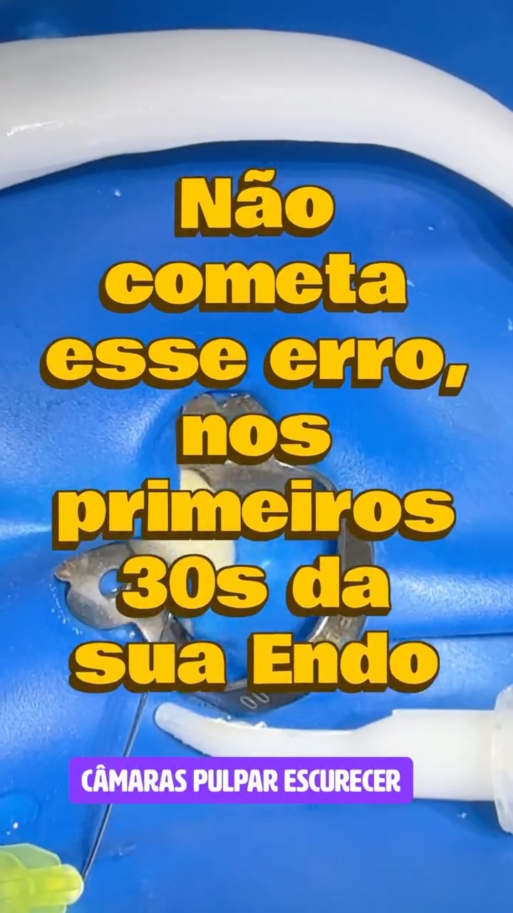 Escurecimento pós-endodontia começa, muitas vezes, na CÂMARA — não no canal. 🦷⚠️
📍Após remover a polpa coronária, a câmara pulpar vira um “reservatório” de sangue + restos orgânicos + pigmentos que impregnam dentina e podem comprometer a estética.
✅ NaOCl 5,25% na câmara: dissolve tecido orgânico e ajuda a remover resíduos aderidos.
✅ H₂O₂ 10 volumes na câmara: auxilia na limpeza de resíduos hemáticos e pigmentos (uso controlado).
🎯 Mensagem-chave: esse passo, feito logo após a remoção da polpa coronária, pode reduzir muito o risco de escurecimento — principalmente em anteriores.
Pergunta (engajamento):
Você tem um protocolo fixo para “câmara limpa” ou ainda trata isso como detalhe? 👇
📌 Salve para usar no próximo caso estético.
🔁 Envie para quem ainda subestima a câmara pulpar.
#odontologia
#dentista
#endodontia
#odontobrasil
#saudebucal