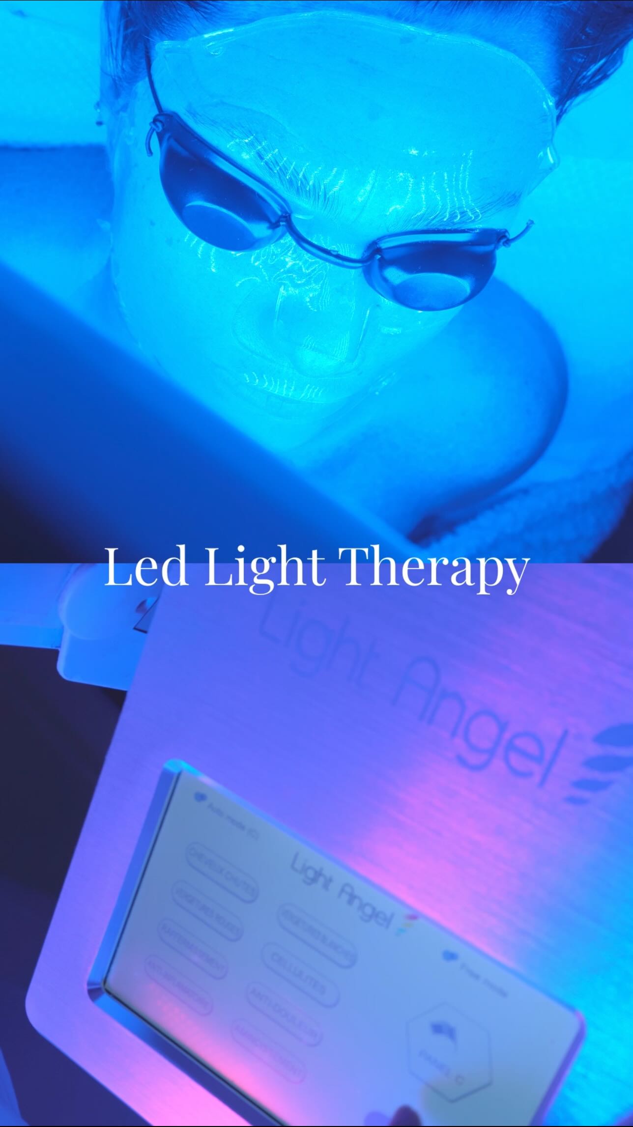 Couperose Treatment: Seeing is Believing at Led Light Therapy Amsterdam!✨
The Triple Power Treatment 🛡️
Our targeted programs for Couperose and Acne combine three of the most effective technologies in the industry:
• Ultrasound Cleaning: Gently vibrates away impurities without irritating sensitive skin.
• Galvanic Treatment: Deeply purifies by liquefying trapped debris, refining your texture instantly.
• LED Light Therapy: Using medical-grade wavelengths to strengthen capillary walls and calm inflammation at a cellular level.
Why LED Light Therapy? 💡
The best part? When you do LED Light Therapy, you never lose what you gain. It builds a lasting foundation of collagen and health that stays with you.
Always Moisturize Deeply 💧
As you can see in our results, the key to that healthy „after“ glow is deep moisture. We ensure your skin is saturated with hydration to lock in the healing benefits of the light.
Ready for your own transformation?
🌟 BOOK YOUR FIRST CONSULTATION NOW 🌟
Link in Bio for a FREE consultation. Let’s create your personalized path to porcelain skin.
📍 Le Sublime - Amsterdam Skin Specialist
#CouperoseTreatment #AmsterdamSkinCare #RednessRelief #LEDLightTherapy #galvanicfacial
