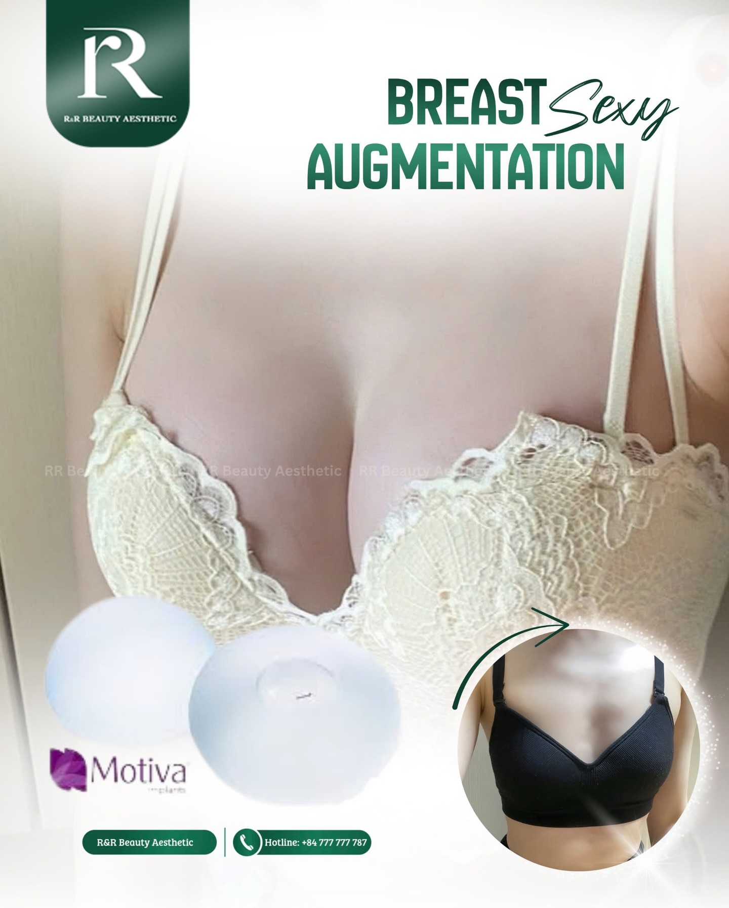 ✨ Sexy Breast Augmentation — Refined Curves, Confident You
Designed for women who want natural fullness, elegant cleavage, and a beautifully balanced silhouette.
✔️ Natural-looking volume with smooth, feminine contours
✔️ Customized implant selection for your body shape
✔️ Soft touch, balanced projection — never overdone
✔️ Performed & closely supervised by medical specialists
✔️ Safe procedure with professional post-operative care
📩 Message us for a private consultation
----
📞 Hotline: +84 777 777 787
👉 https://linktr.ee/rrbeauty.group
.
.
.
#breastaugmentation #sexycurves #naturalresults #rrbeautyaesthetic #medicalaesthetics
sexy breast augmentation natural breast implants medical supervised cosmetic surgery feminine curves safe aesthetic clinic