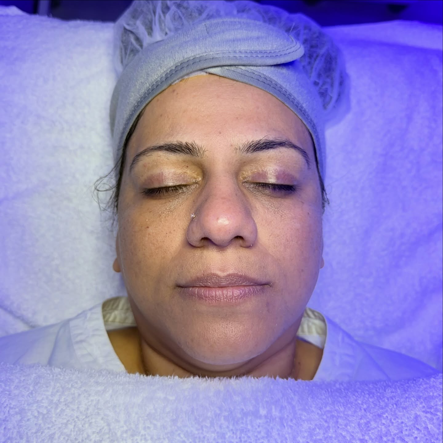 🫶🏾Texture. Dullness. Congestion.
This is your sign to stop layering products and start getting RESULTS.
Today’s Crystal HydroDerm Duo treatment is giving deep exfoliation + vacuum-powered hydration in one powerful session. We’re removing built-up dead skin, clearing out congested pores, and infusing customized serums to restore glow, smooth texture, and bring this skin back to life ✨
If your skin feels rough, looks tired, or keeps breaking out in the same areas — it’s not “bad skin.” It’s buildup.
At Luminance Beauty & Body in Roswell, Georgia, we specialize in corrective facials that target texture, congestion, hyperpigmentation, and dull skin safely and effectively.
Glow beyond beauty.
Book your Crystal HydroDerm Duo today. 💧
#hydrofacial #atlantaspa #atlfacials #glowingskin #atlantaesthetician