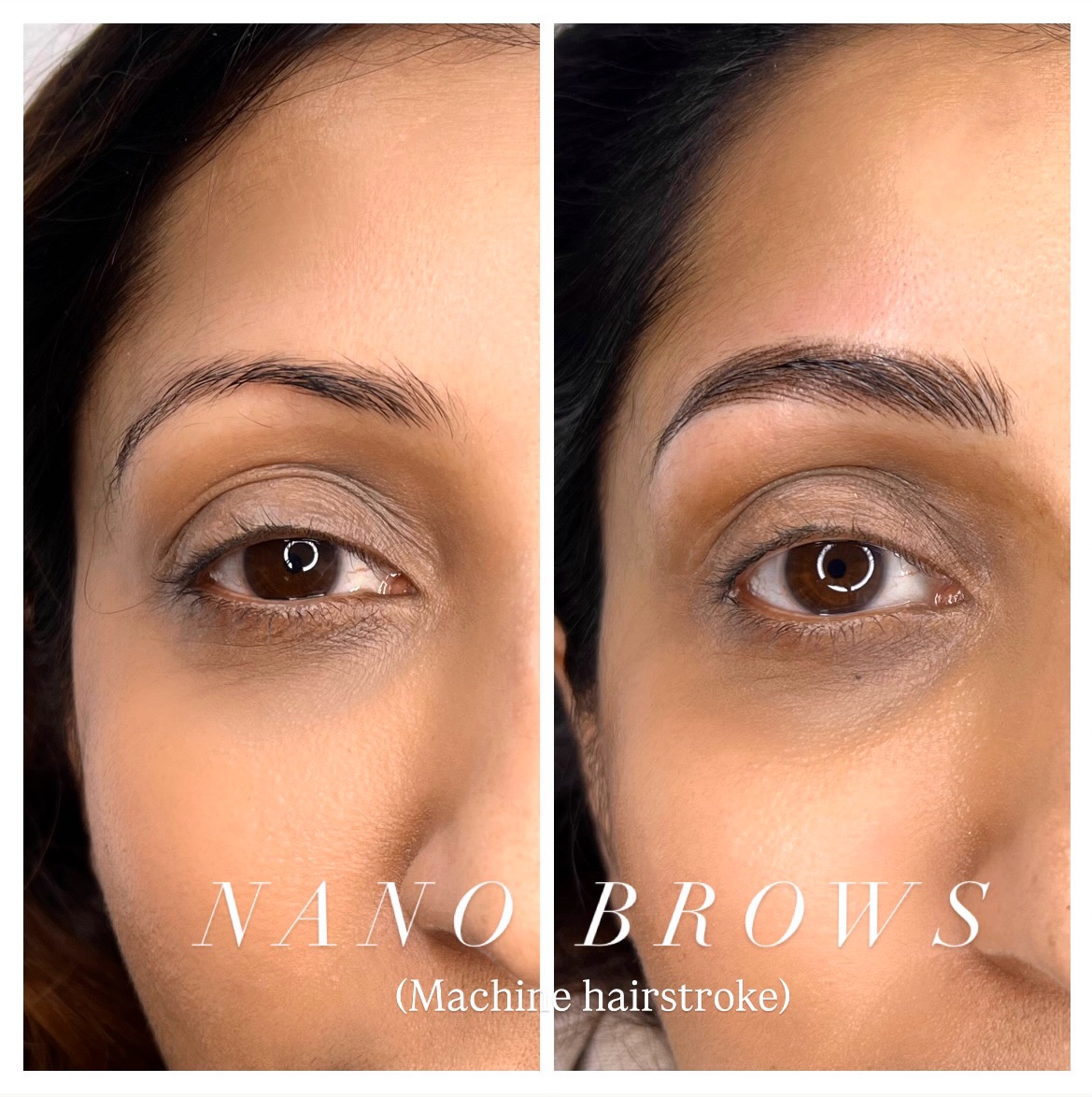 Nano Brows – Hyper-Realistic Brows
Nano brows are created using an advanced machine technique (not microblading), allowing for exceptional precision and longevity. This treatment are great for all skin types—especially if you have oily skin or struggled with microblading before ✨
PhiBrows artist - SPMU specialist based in Ealing Broadway, West London.
🔖 PriceList - saved in highlight
Book your appointment now! 💕
📲 Link in bio
📩 DM or WhatsApp: +44 7399288821
#phibrowslondon #ealingmicroblading #nanobrows #hyperrealisticbrows #laserremoval