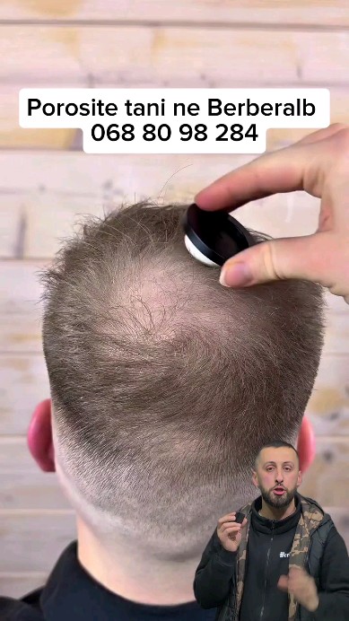 Mbulo zonat e flokeve te rena me Bune.
Porosite tani ne Berberalb 🗳 #berberalb #albania #berber