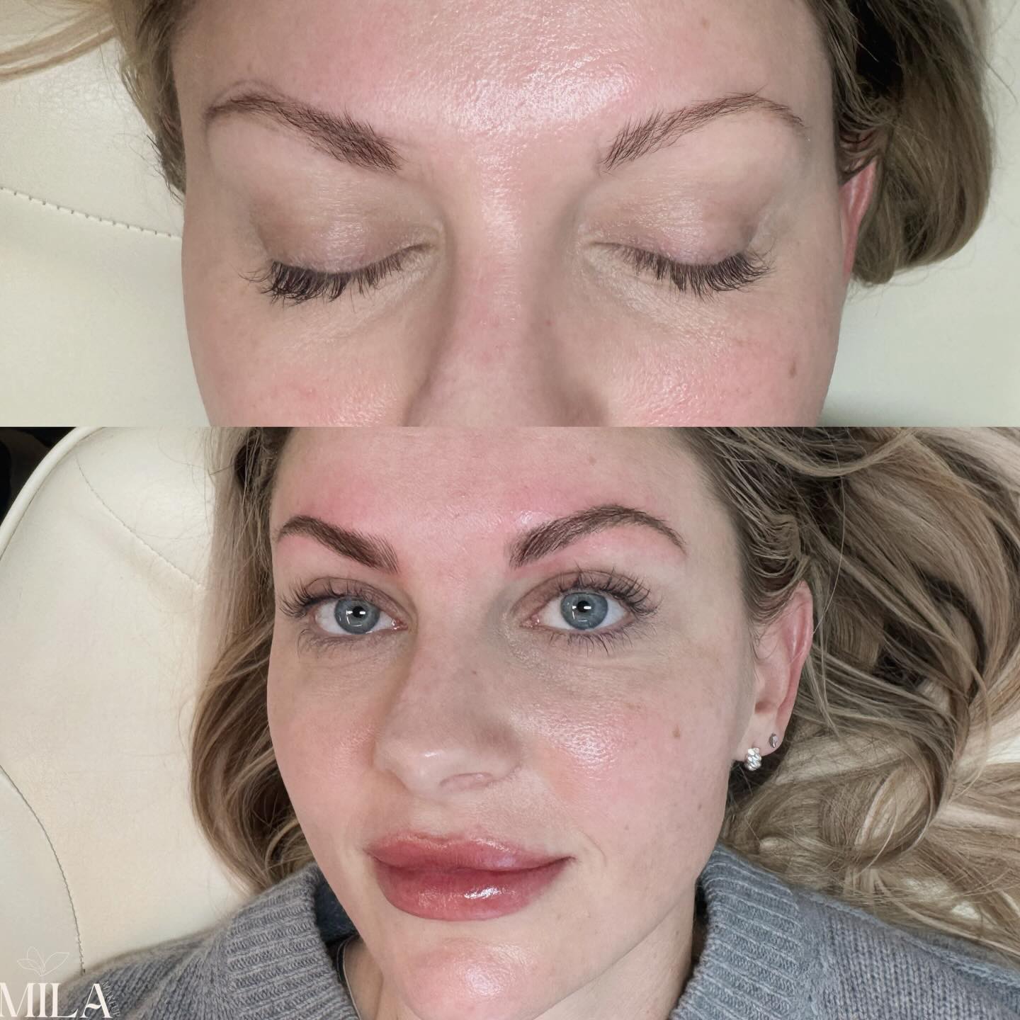 Old school brows with a modern touch!
We kept the softness, updated the shape, and enhanced her natural beauty 💖
📍 Book your appointment
💬 DM me
#BrowDesign #PerfectBrows #BeforeAndAfter #NaturalBeauty