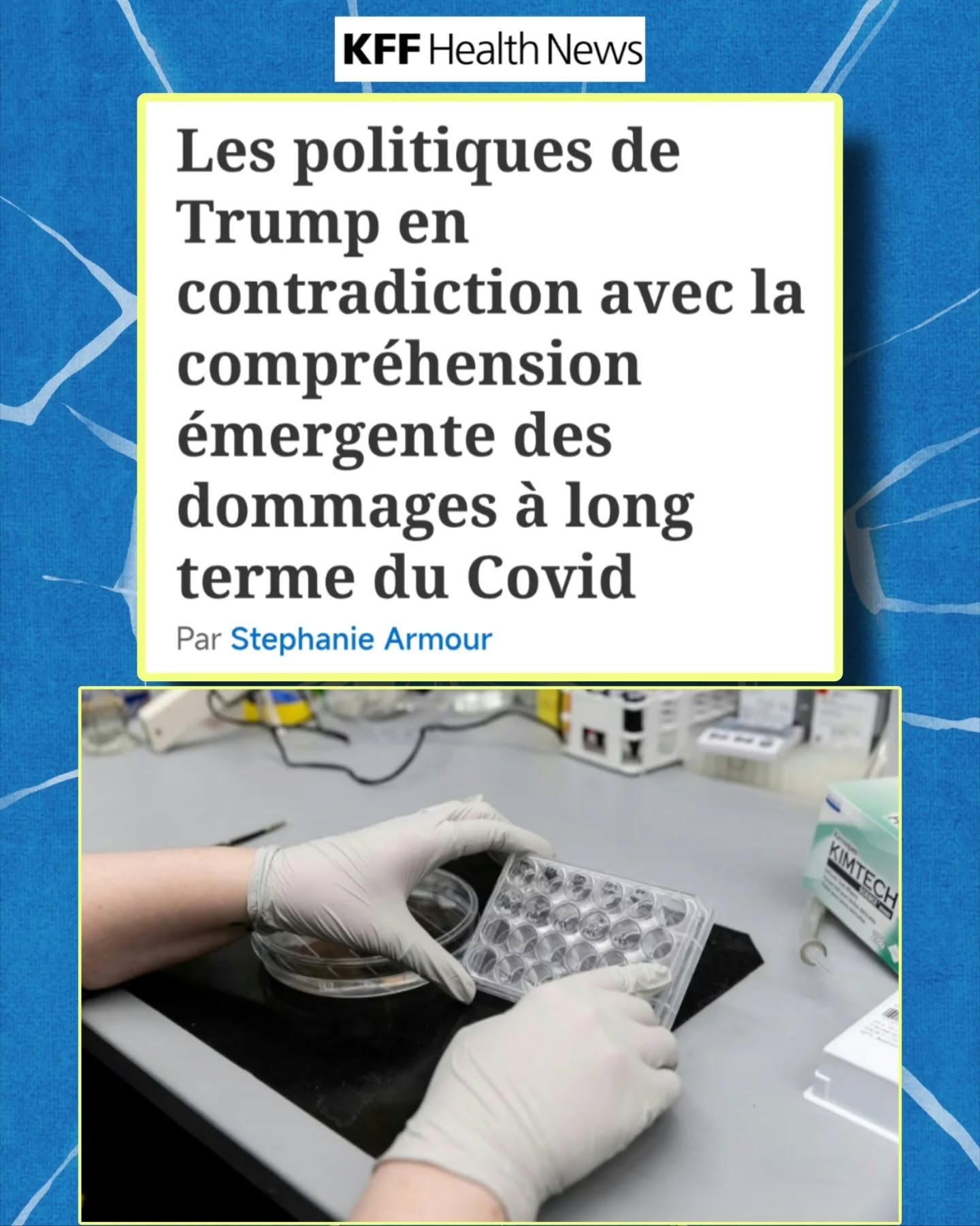 🧵« Les politiques de Trump en contradiction avec la compréhension émergente des dommages à long terme du Covid »
➡️Ce thread est un résumé de l’article de Stephanie Armour analysant le décalage entre les politiques publiques et l’état actuel des connaissances scientifiques sur les effets à long terme du #Covid19
#CovidLong
🦠En mai 2023, les autorités américaines ont déclaré la fin de la pandémie de #Covid19
➡️Pourtant, la science continue de montrer que le virus peut provoquer des dommages durables, parfois graves, même après des infections bénignes.
🧠Les études récentes identifient des risques à long terme :
🧠Troubles cognitifs
🧓Vieillissement cérébral accéléré
❤️Complications cardiovasculaires
🎗️Réactivation de cancers
👶Impacts possibles sur le développement des enfants exposés in utero
➡️Ensemble, ces atteintes sont au cœur du #CovidLong.
🏛️Ces données entrent en contradiction avec les choix politiques récents de l’administration Trump :
🔻Restriction des recommandations vaccinales
🔻Suspension de financements pour de nouveaux vaccins Covid
🔻Réduction du suivi à long terme des personnes infectées
💉 Pourtant, de nombreuses études montrent que la vaccination réduit :
⚠️La gravité des infections
🧠Le risque de séquelles à long terme, y compris du #CovidLong
➡️Même si la protection diminue avec le temps.
📉Malgré cela, la couverture vaccinale reste très faible aux États-Unis :
Environ 17% des adultes avaient reçu le vaccin Covid mis à jour 2025–2026 en janvier.
🗣️Alerte des chercheurs :
« Les gens l’oublient, mais l’héritage du Covid sera long. Nous devrons étudier ses effets chroniques pendant encore des années. » Michael Osterholm, épidémiologiste (Université du Minnesota)
💰Le coût du Covid Long est déjà massif :
🌍Environ 1 000 milliards $ par an dans le monde
🇺🇸Environ 9 000 $ par patient aux États-Unis
📉Environ 170 milliards $ de pertes de revenus annuelles aux États-Unis
📊 À titre de comparaison :
La grippe saisonnière 2023–2024 a coûté ~29 milliards $ (soins + pertes de productivité)
➡️Le Covid Long représente un impact économique bien supérieur.
⏬Suite en commentaire⏬ @kffhealthnews