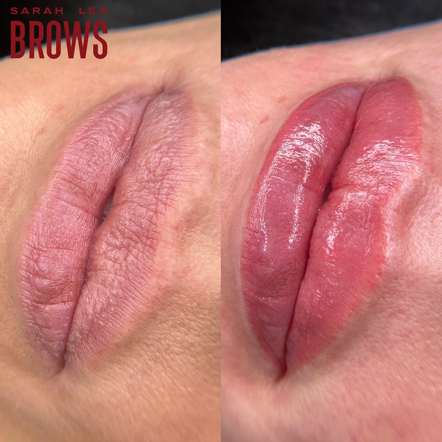 What colour would you pick đđđđđ
đđŤđĽĽ
~ Lip blush Tattoo
~ Completely customised colour and shape to suit each individuals wants/needs. Appears bold for 5 days but heals to a soft flush of colour similar to that of a tinted balm
~ Lasts 2+ years
~ Anaesthetic used throughout
~ Bookings & Info:
www.sarahleabrows.com