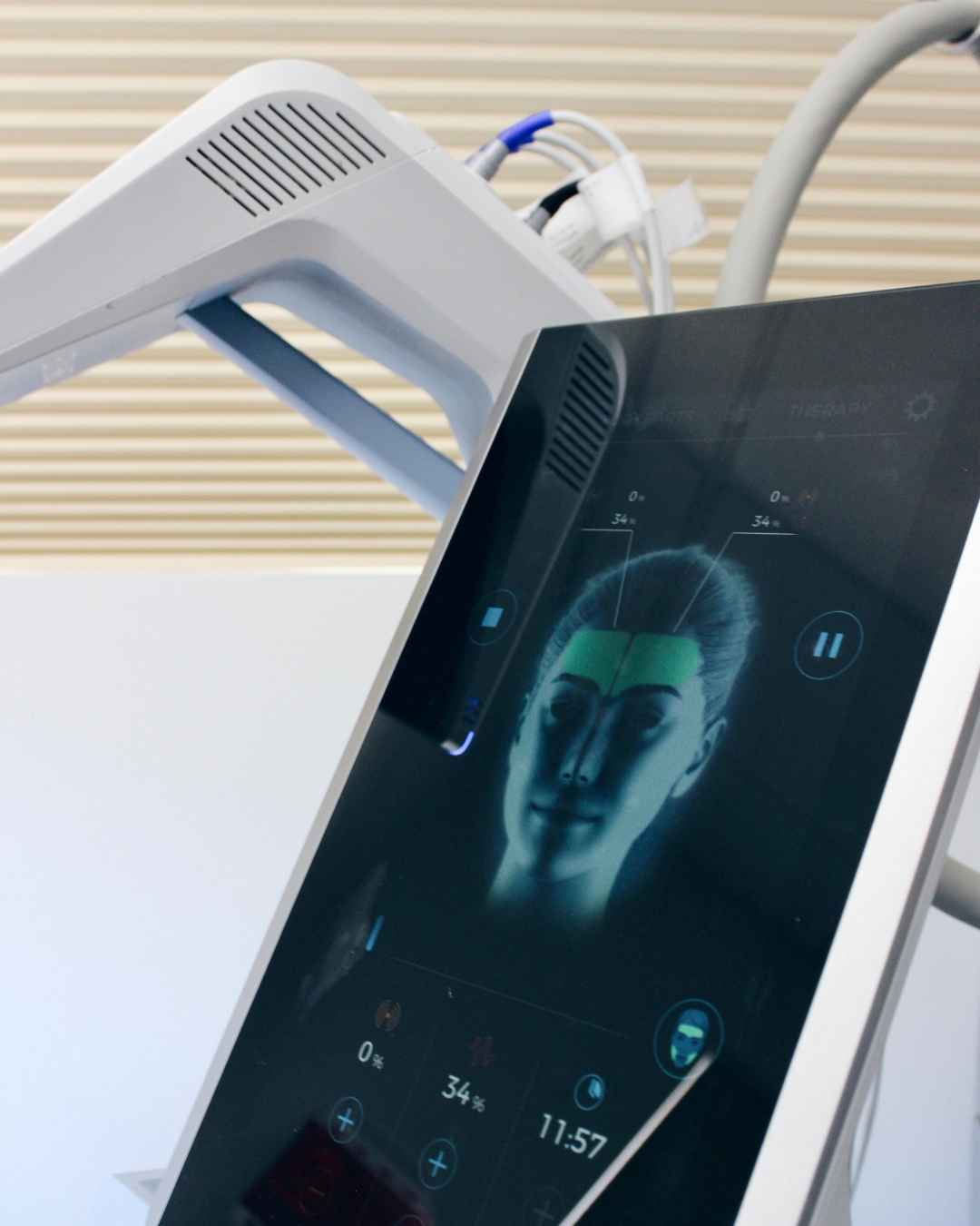 Lift, tone, and smooth—no needles, no downtime.
EMFACE is a non-invasive treatment that targets both skin and muscle to naturally restore facial contours and reduce the appearance of wrinkles.
⚡ Strengthens facial muscles
⚡ Boosts collagen and elastin
⏱️ Quick treatments with zero downtime
A modern approach to facial rejuvenation that works with your natural anatomy—for results that look refreshed, not overdone.
Book now!
📞 Call: 520-618-0232
➤ Visit: 2732 N. Alvernon Way Tucson, AZ 85712
➤ Visit: http://www.renew360az.com
#ReNew360 #TucsonArizona #Emface