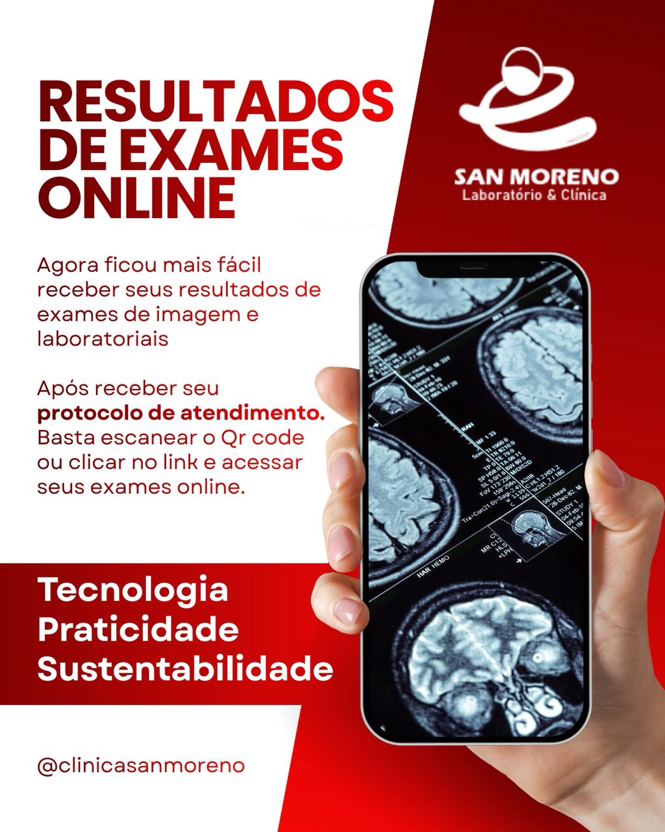 🚀✨ **Mais praticidade, inovação e agora mais sustentabilidade para você!**
A **Clínica SAN Moreno** apresenta o novo **sistema on-line para resultados de exames de imagem e laboratoriais** 💻📲
Pensando no seu conforto e na sua rotina, disponibilizamos uma plataforma moderna, segura e fácil de acessar. Agora você pode consultar seus resultados onde estiver, a qualquer hora, sem precisar se deslocar até a clínica.
🔎 **Mais rapidez no acesso aos resultados**
🔐 **Segurança e confidencialidade das informações**
📱 **Acesso pelo celular, tablet ou computador**
⏱️ **Mais comodidade e economia de tempo**
🌱 **Menos papel, mais cuidado com o meio ambiente**
Com a digitalização dos resultados, reduzimos o uso de impressões, contribuindo para práticas mais sustentáveis e responsáveis. Tecnologia e consciência ambiental caminham juntas para cuidar de você e do planeta.
💙 **Clínica SAN Moreno** – Cuidando da sua saúde com inovação, responsabilidade e compromisso com o futuro.
#Saúde #ExamesOnline #Sustentabilidade #TecnologiaNaSaúde #ClínicaSANMoreno CuidadoComVocê