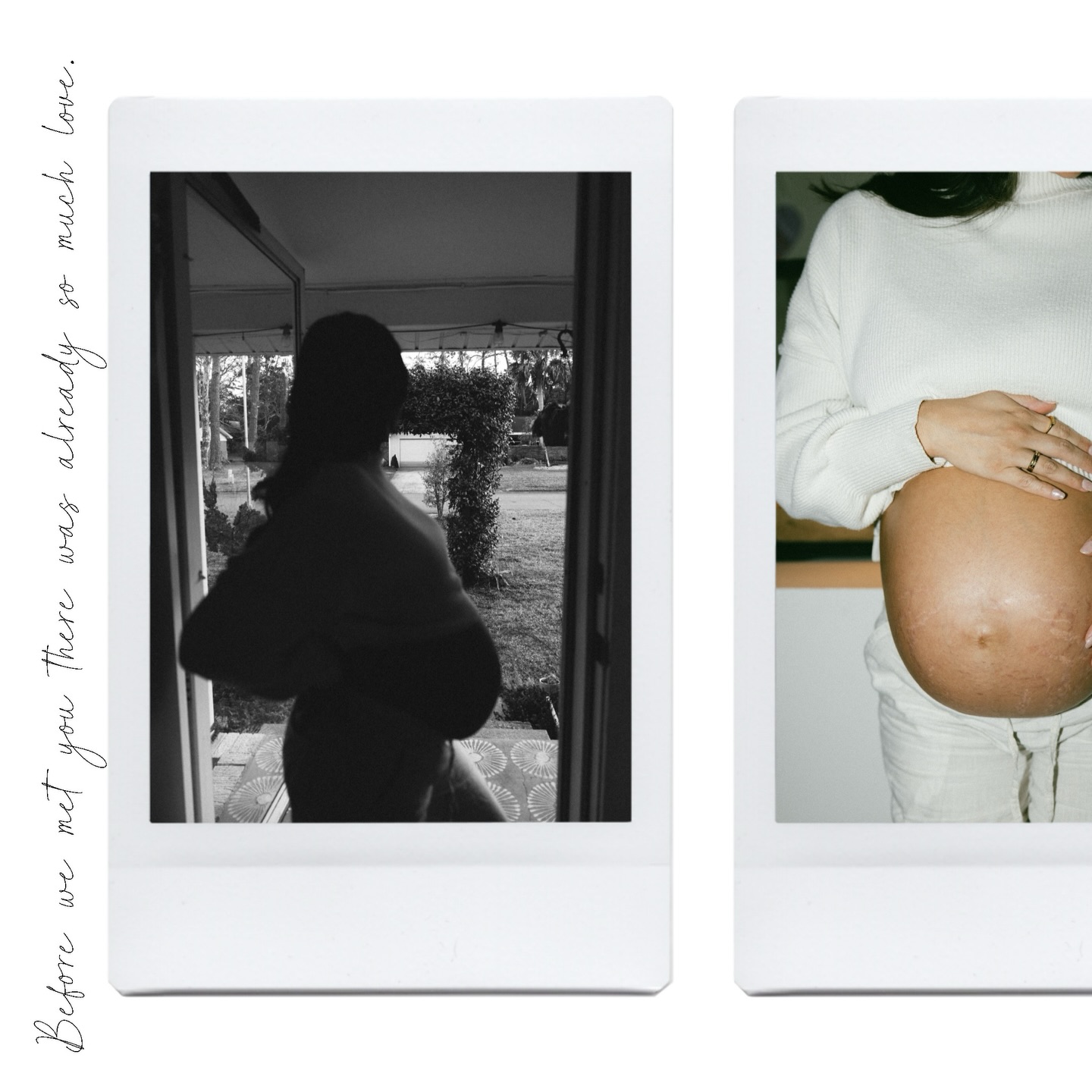 Pregnancy isn’t just a wait for birth.
It’s a quiet becoming.
Before your baby is ever in your arms,
they already know your voice,
your rhythm,
your presence.
This season is fleeting —
even when it feels endless.
And once it passes, it can never be recreated.
Documenting pregnancy isn’t about how it looked.
It’s about remembering how it felt to love someone
before ever meeting them.
Grateful to create something so meaningful with @arianajohnsonphotography — honoring the beginning, the becoming, and the sacred in-between 🤍
How has pregnancy changed you already? Tell us below what this season is feeling like for you✨