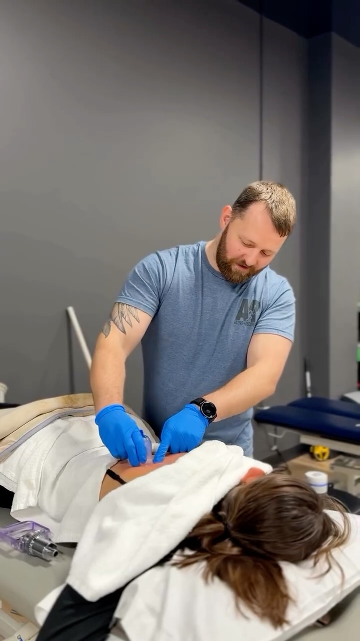 Today, PT Tyler is working with Zoey, focusing on spine treatment for scoliosis and supporting recovery after more than multiple leg surgeries.
Her session includes targeted stretching and cupping therapy, a technique used to improve circulation, reduce muscle tension, and support mobility around the spine and lower body.
Every treatment is tailored to Zoey’s unique needs, helping her move with more comfort and confidence. It’s a reminder that physical therapy isn’t one-size-fits-all—it’s about listening, adapting, and supporting the whole person through every step of their journey.
We’re proud of the work being done here and the strength Zoey brings into every session.
Active Recovery Physical Therapists – Helping Hattiesburg move, heal, and thrive.
