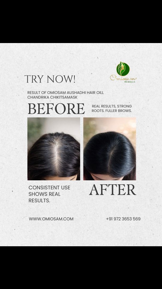 Confused? Which Hair Care Products To Choose? Give A Chance!
The Best Solution For Your Hair. Omiosam Products Based On Ayurvedic Formulation.
Omiosam Luxury Products For Luxury People. 100% Natural Products.
Shop Now
www.omiosam.com
+91 9723653569