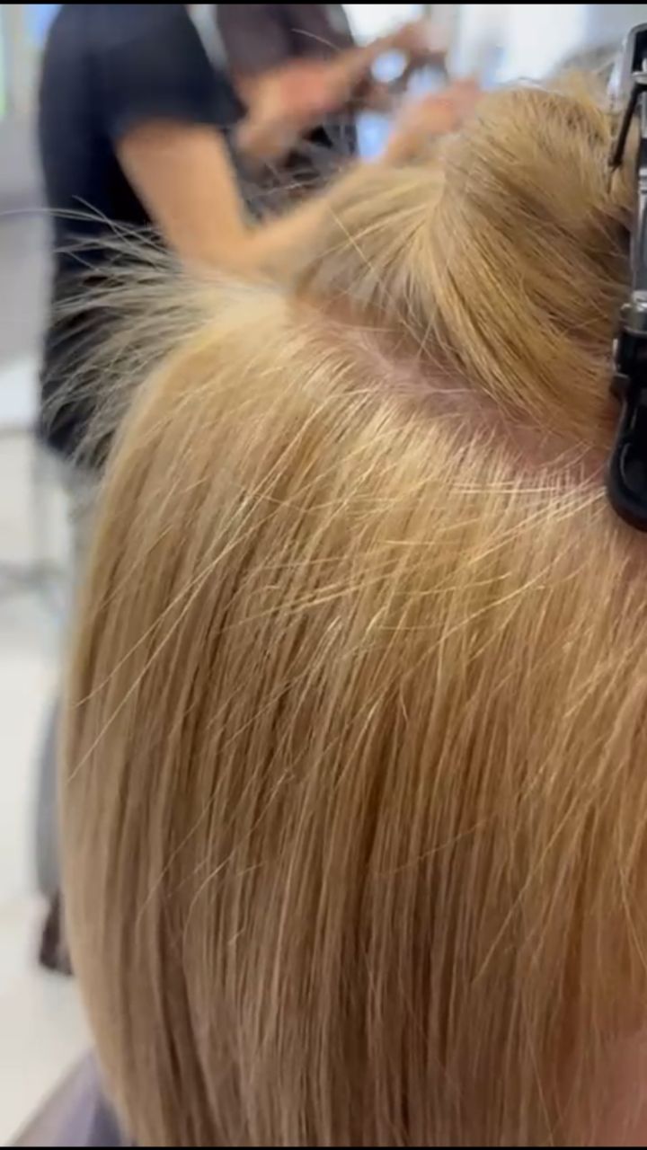 ✨QUANDO LA CURA È QUELLA GIUSTA, I RISULTATI SI VEDONO.
In questa video stai guardando una ricrescita evidente di baby hair: piccoli capelli nuovi, più forti, più sani… segno che il cuoio capelluto è tornato a respirare 🌿
Tutto questo grazie alla nostra cura d’urto di Ossigeno-Terapia, potenziata dal Siero Rigenerante Anticaduta TricovitaLab 💧 completamente naturale e ricco di attivi funzionali.
🔎 Quali problemi trattiamo?
• Caduta eccessiva
• Diradamento
• Capelli che si assottigliano
• Ricrescita lenta
• Cute irritata e impura
• Desquamazione
• Cute grassa e squilibri sebacei
• Cuoio capelluto stressato e poco ossigenato
💨 Perché l’ossigeno è così importante?
L’ossigeno stimola la microcircolazione, riattiva i bulbi “addormentati”, purifica in profondità e riequilibra il cuoio capelluto, creando l’ambiente ideale per una nuova crescita sana.
🌱 In sinergia con il nostro Siero TricovitaLab:
• Rafforza il bulbo
• Riduce la caduta
• Stimola la ricrescita
• Migliora spessore e densità
• Riequilibra la cute
• Dona energia e vitalità ai capelli
Risultato? 👉🏻 Capelli più forti, più corposi e una ricrescita visibile già dalle prime settimane.
Se anche tu noti caduta, cute grassa, desquamazione o irritazioni, è il momento di intervenire ✨
📩 Scrivimi per una consulenza personalizzata.
#ossigenoterapia #anticaduta #ricrescitacapelli #tricovitalab #curadelcuoiocapelluto