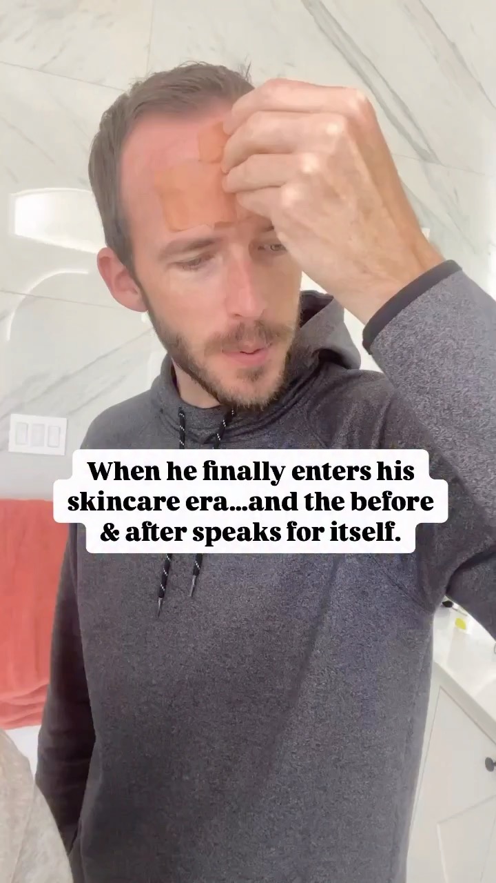 The men have entered their skincare era. Frownies and all. And we’re not mad about it.
Men can use Frownies too. Tag the man in your life who needs this!
Or send this to your man who needs to give Frownies a try!
Look out ladies…. the men might sell these out!
#FrowniesCananda #FrowniesFam #MenofFrownies #MoreThanSkinDeep #HowtoApply #confidencelooksgood