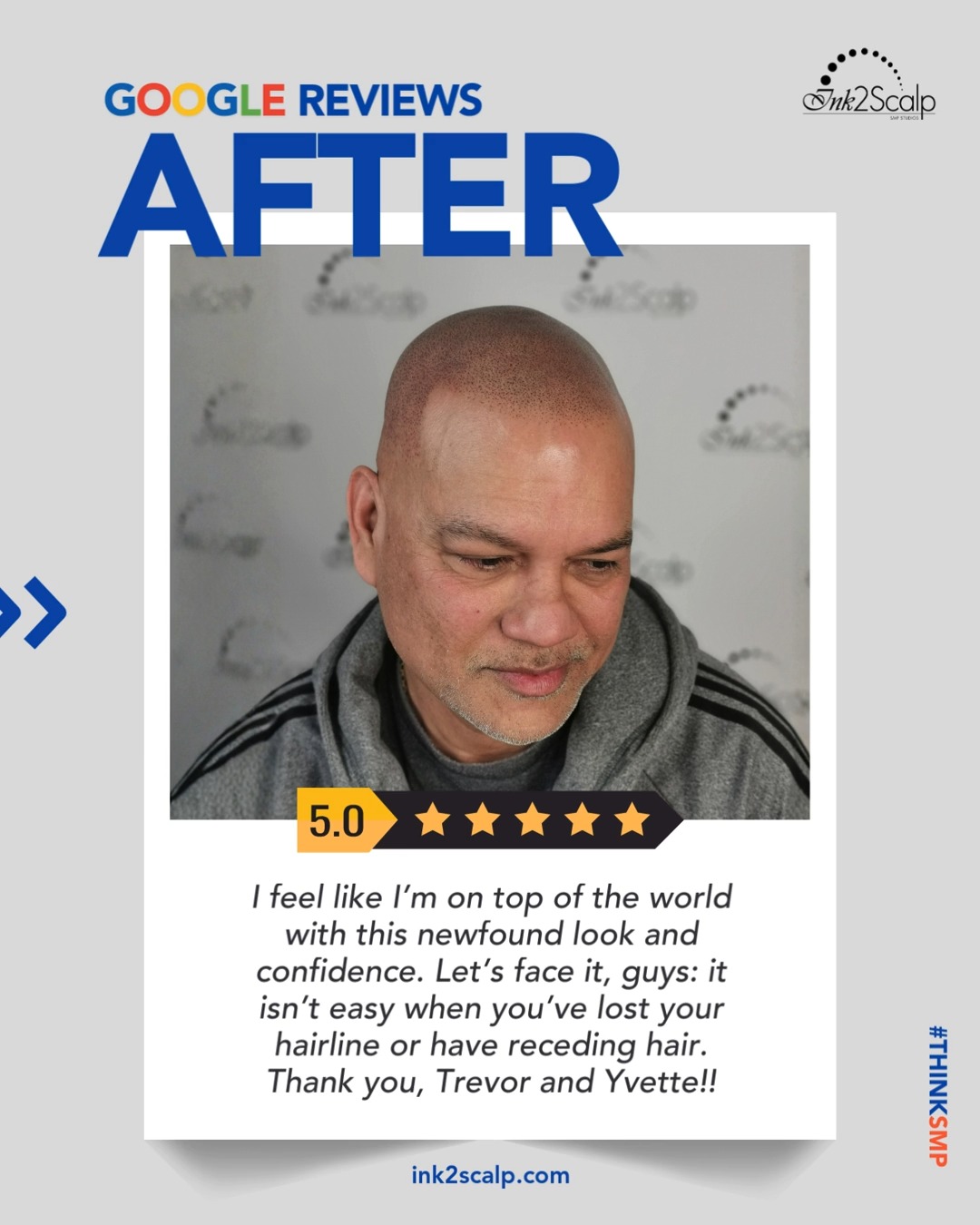 The path to a transformed look starts with education and research. Before visiting Ink2Scalp SMP Studios, Neil Singh evaluated how Scalp Micropigmentation could address his specific hair loss pattern. This before shot captures the starting point of his journey.
One year later and the results remain consistent. Neil Singh after his final SMP session at Ink2Scalp SMP Studios, where we focused on creating a natural hairline that suits his facial structure and age. Scalp Micropigmentation is a non-invasive solution for receding hairlines and thinning crowns. Thank you, Neil, for allowing Trevor and Yvette to showcase this high-quality, 1 year healed result.